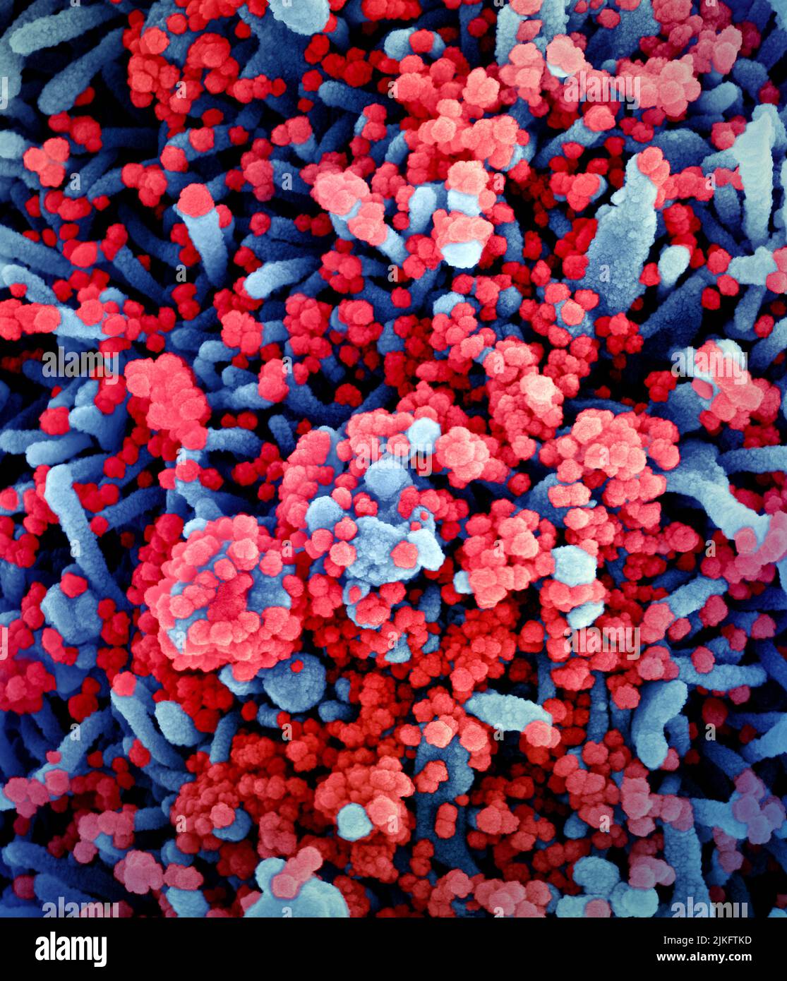 Micrografia elettronica a scansione colorata di una cellula (blu) fortemente infettata con particelle di virus SARS-COV-2 (rosso), isolate da un campione di paziente. Immagine richiesta dal NIAID Integrated Research Facility (IRF) a Fort Detrick, Maryland. Foto Stock