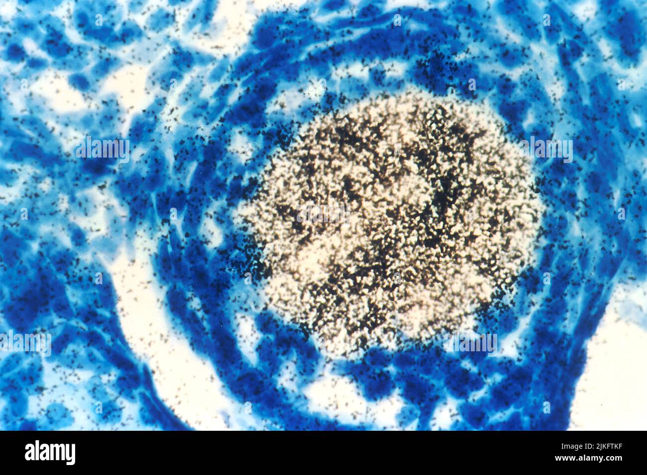 Una tecnica chiamata ibridazione in situ mostra se un gene è espresso in cellule e fornisce anche indizi circa la funzione del gene. Questa tecnica ha aiutato a identificare gli oncogeni attivati nelle cellule tumorali e le loro controparti normali nelle cellule normali, in molte specie diverse. In questa fotografia, un segmento marcato di DNA (un noto oncogene) è stato posto in un ovocita di topo, una cellula che si sviluppa in un uovo maturo. Il DNA marcato appaiato con (o ibridizzato) copie multiple di RNA nell'ovocita di topo. Foto Stock