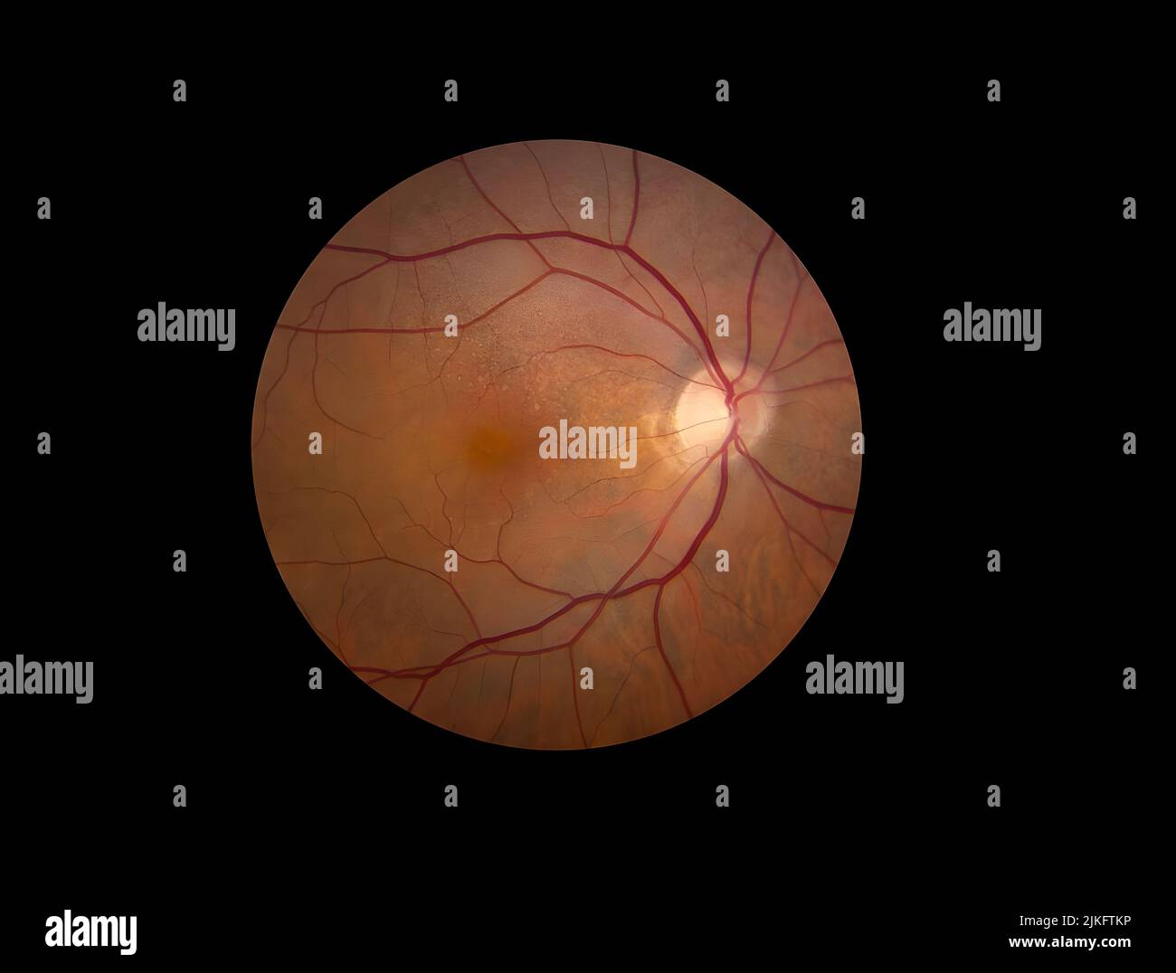 Un nuovo studio clinico condotto dal National Eye Institute (NEI), parte degli Istituti nazionali di Salute, seguirà 500 persone in cinque anni per saperne di più sulla storia naturale della degenerazione maculare legata all'età (AMD). Utilizzando la tecnologia più recente per visualizzare le strutture degli occhi e misurare la loro funzione, i ricercatori sperano di identificare i biomarcatori della progressione della malattia, molto prima che progrediscono verso la malattia avanzata e si traducono in perdita della vista. AMD è la causa principale di compromissione della vista e cecità in persone di età pari o superiore a 50 anni negli Stati Uniti. Foto Stock