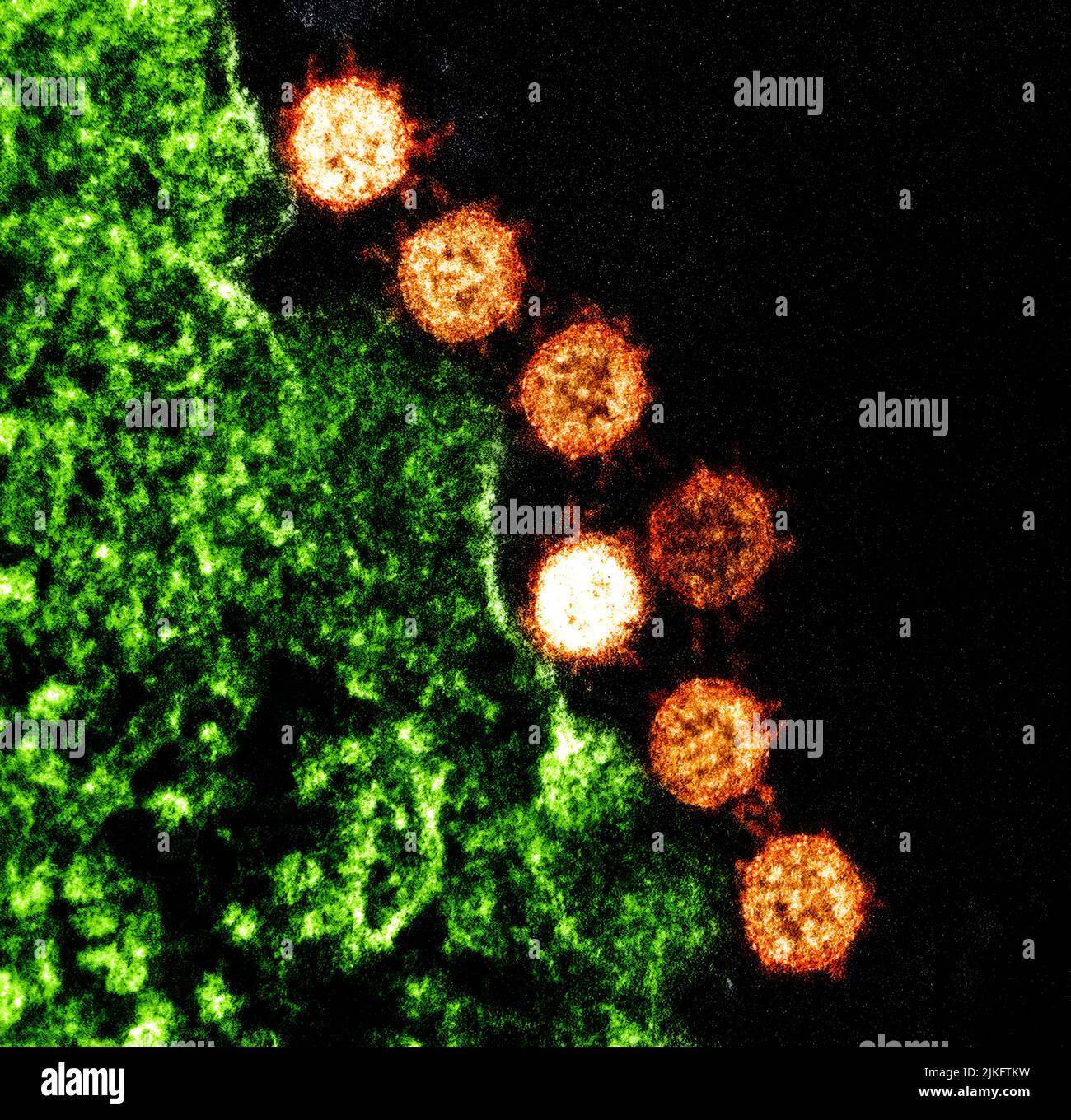 Micrografia elettronica a trasmissione colorata di particelle di virus della sindrome respiratoria acuta grave (SARS) (arancione) trovate vicino alla periferia di una cellula infetta (verde). Foto Stock