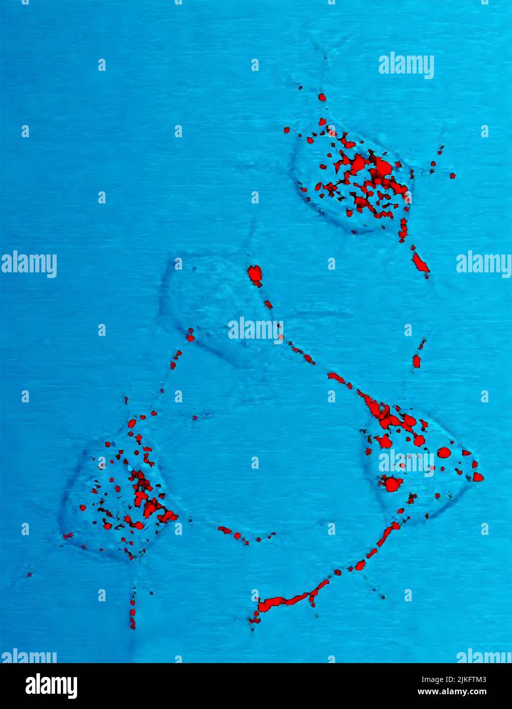 La proteina prione, mostrata in rosso, può diventare infettiva e causare malattie neurodegenerative. Qui, quattro cellule nervose in un topo illustrano come la proteina prionica infettiva si muove attraverso le cellule lungo le connessioni filiformi dei neuriti che le cellule nervose usano per comunicare con le cellule adiacenti. Foto Stock