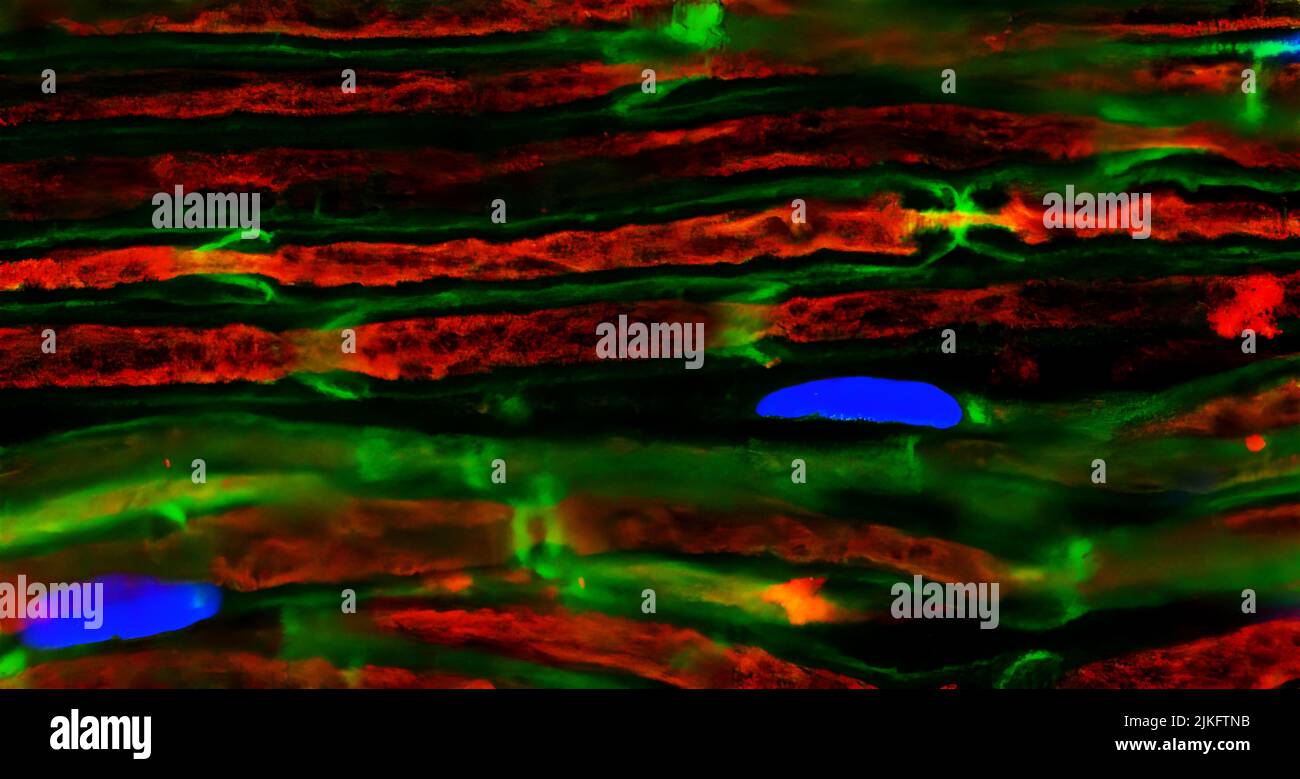Immagine in microscopia di nervi sciatici di topo che mostrano assoni (rosso) avvolti da cellule di Schwann (verde) con i loro nuclei mostrati in blu. Foto Stock