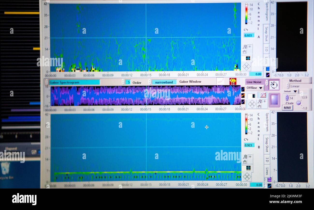 Il neurofeedback rende possibile registrare l'attività elettrica del cervello, l'obiettivo sarebbe per l'individuo di essere in grado di auto-regolare la sua attività neuronale. Foto Stock