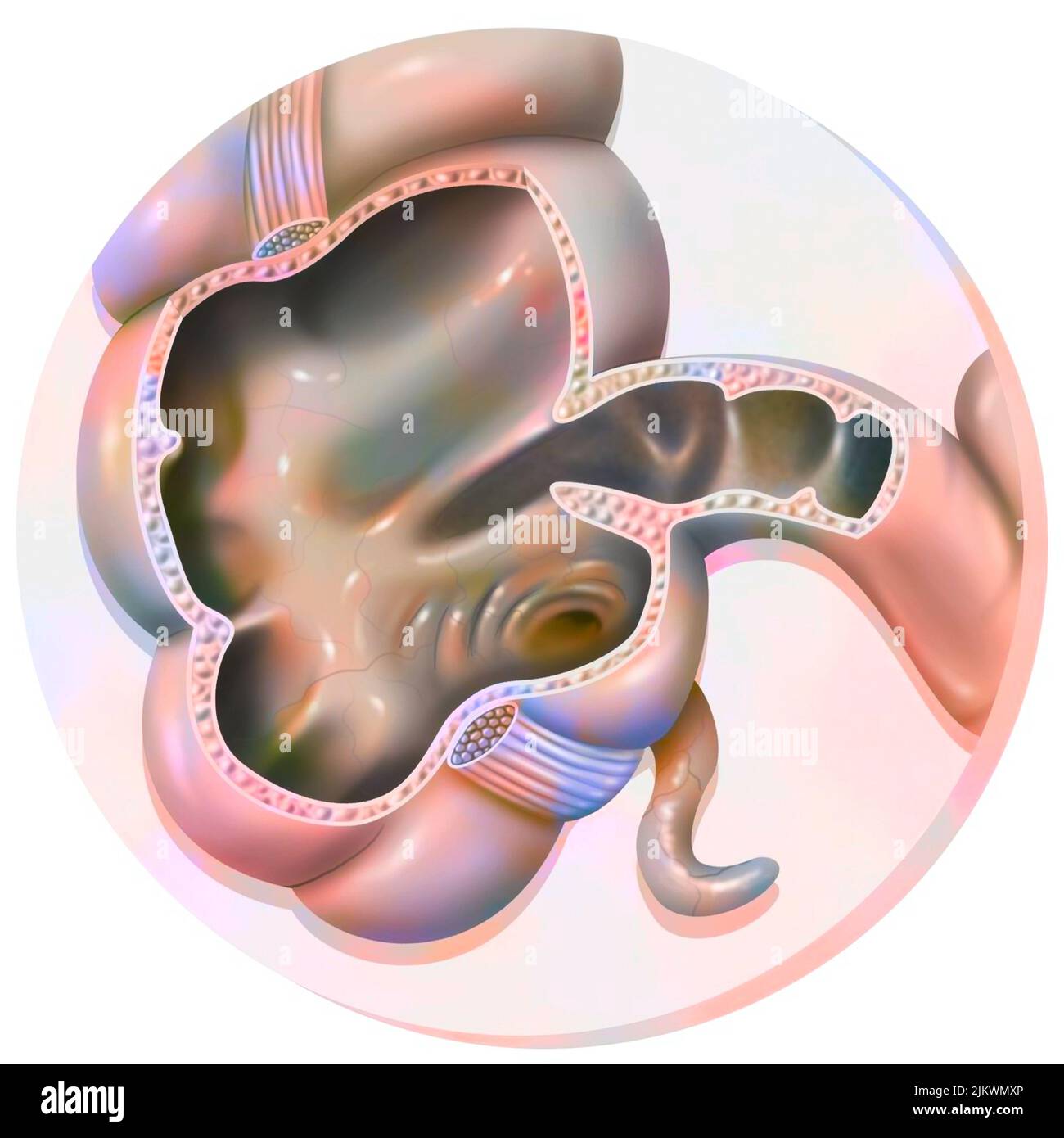 Anatomia del colon: Il secum e l'appendice. Foto Stock
