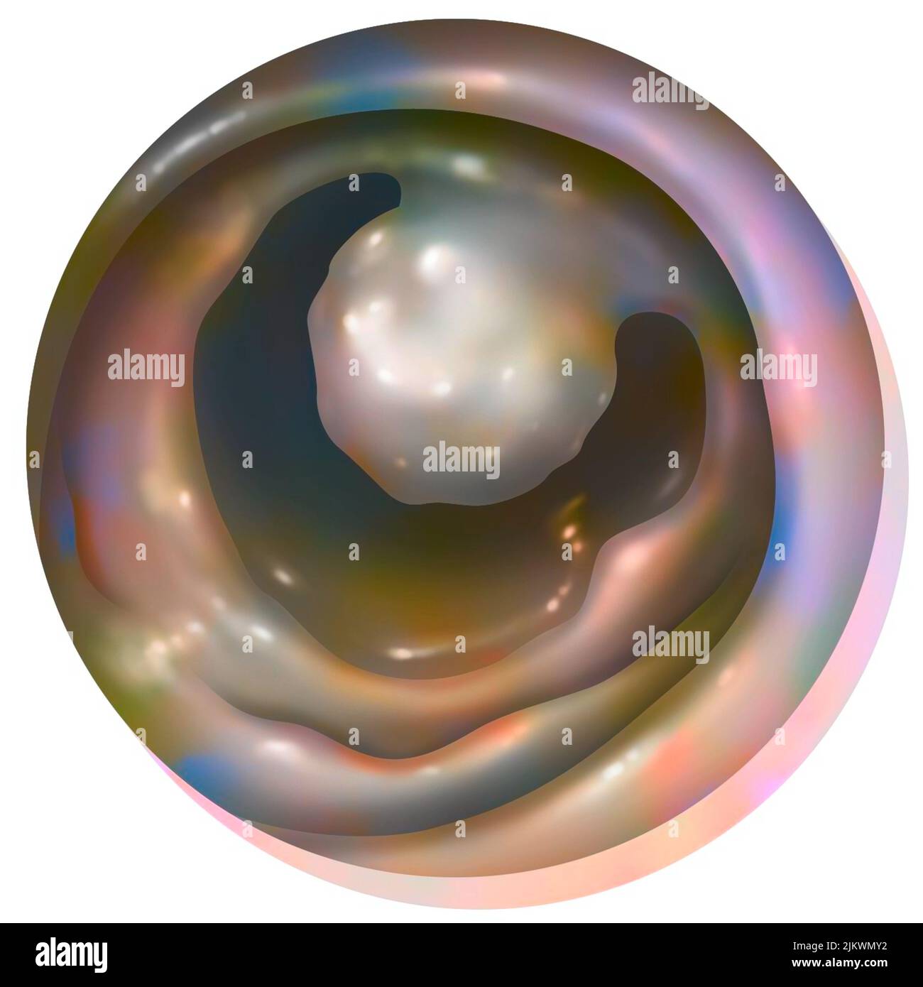 Anatomia del colon: Primo piano di un polipo del colon. Foto Stock