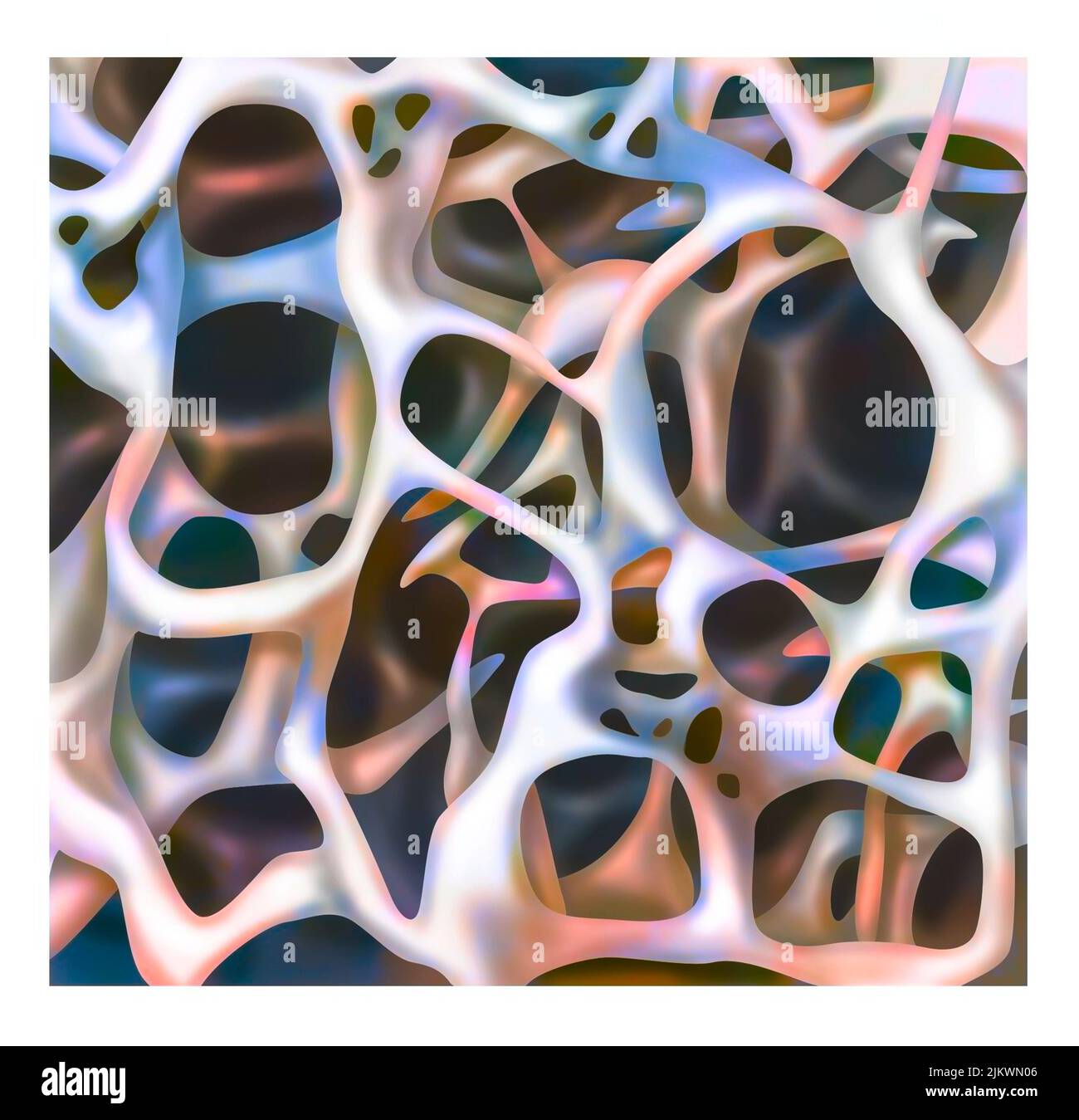 Struttura ossea: Struttura di un osso cannelloso con osteoporosi. Foto Stock