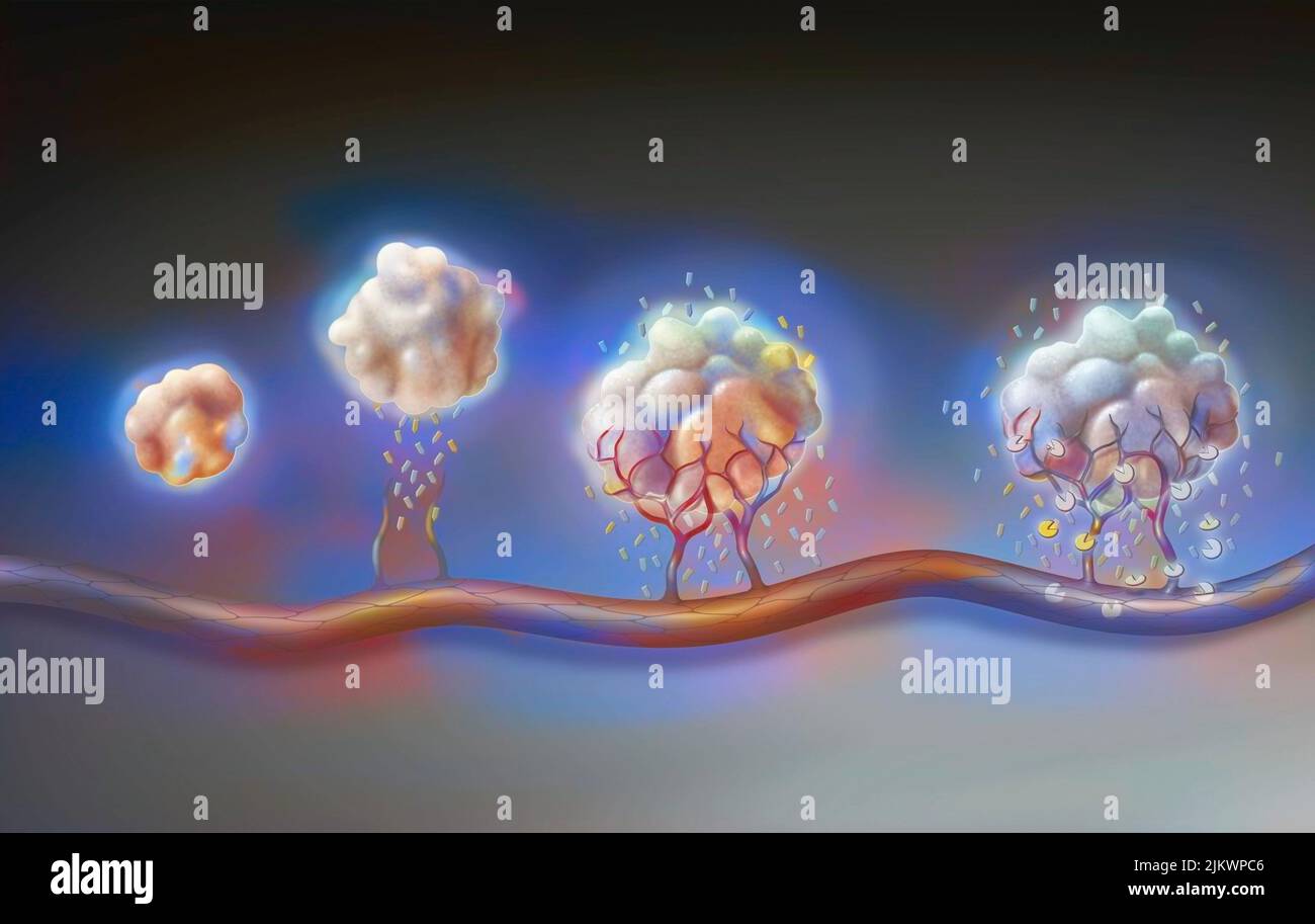 Tumore: Da sinistra a destra, angiogenesi e farmaci antiangiogenici. Foto Stock