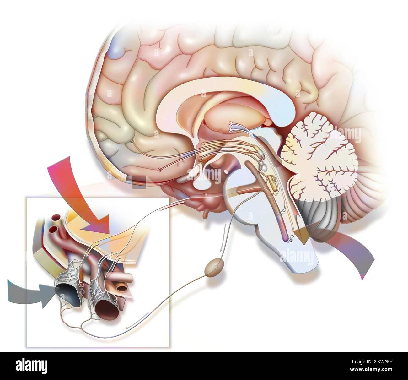 Si ritiene che l'emicrania sia causata dalla stimolazione del nervo trigeminale. Foto Stock