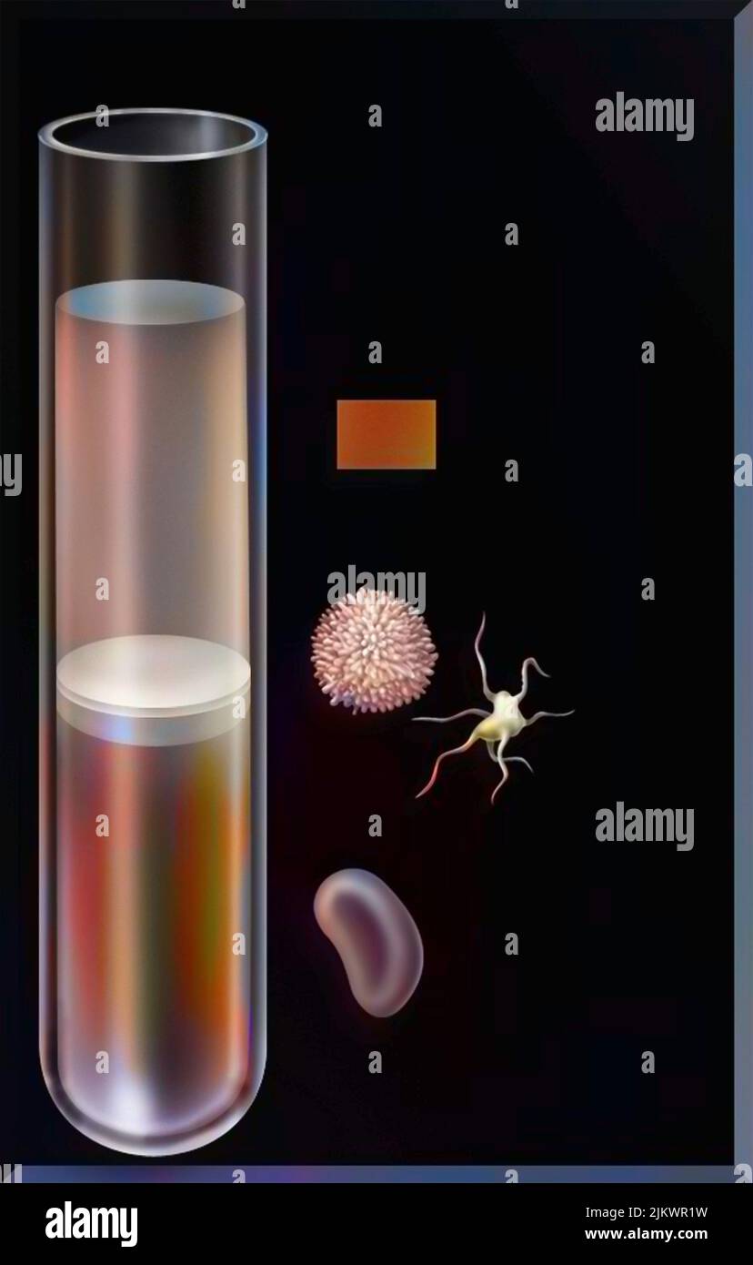 Proporzione dei diversi elementi del sangue (plasma, globuli bianchi, piastrine, globuli rossi) in una provetta. Foto Stock
