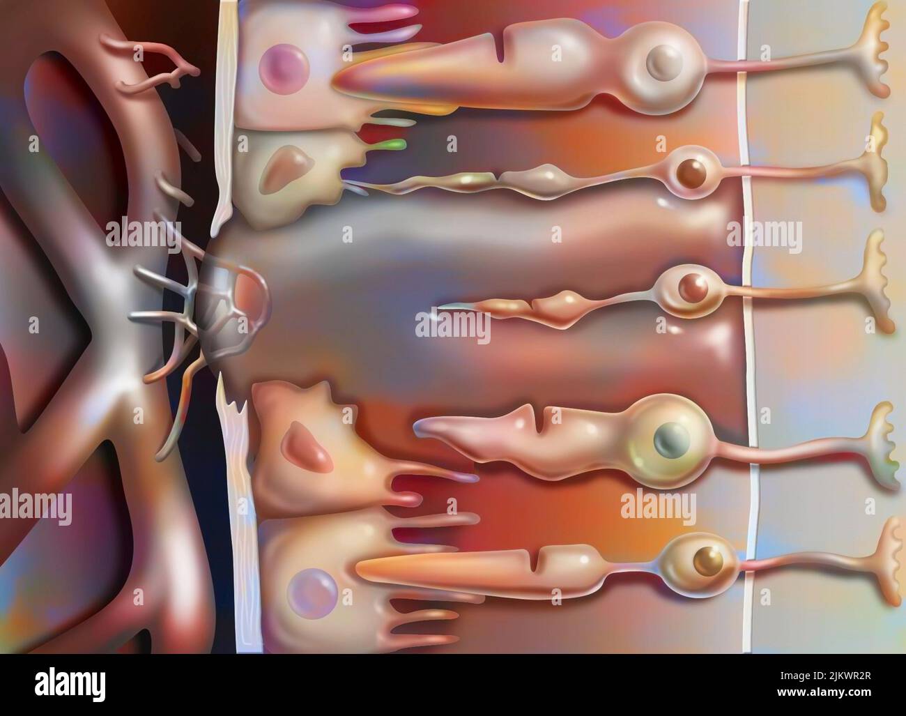 Zoom avanti sulla degenerazione maculare legata all'età che colpisce la macula, l'area centrale della retina. Foto Stock