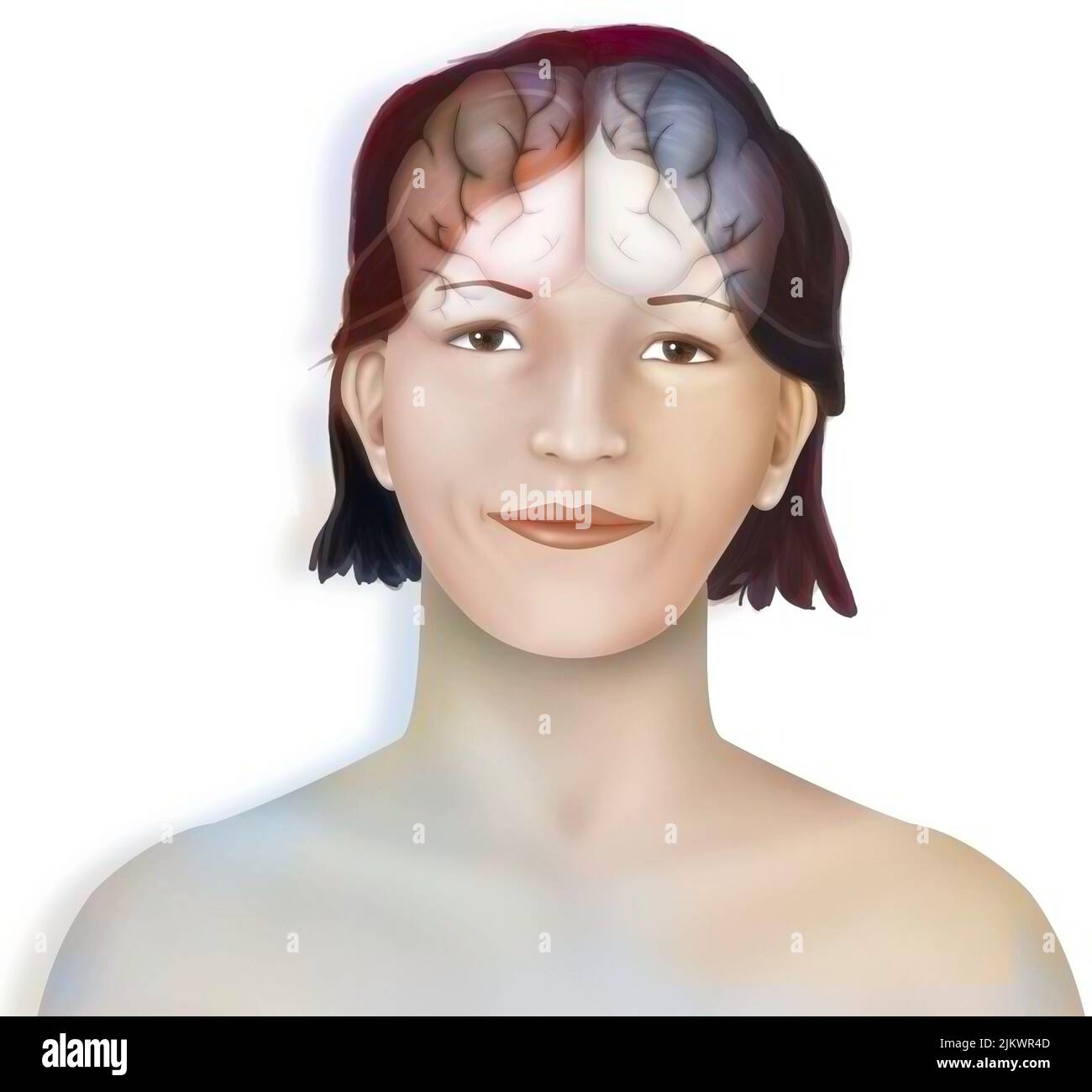 Cervello (emisferi cerebrali destro e sinistro) nel volto di una donna. Foto Stock