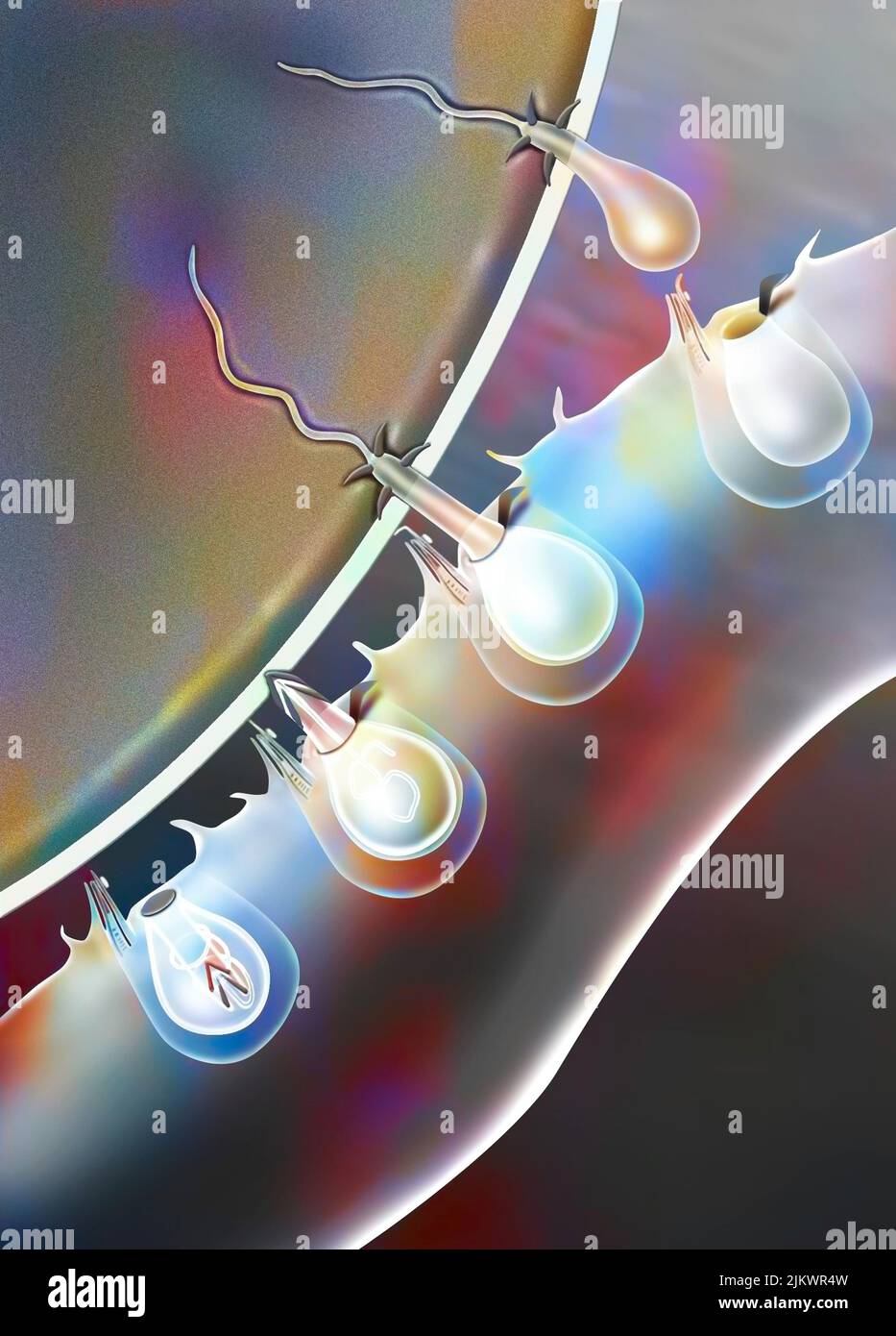 Pungiglione della medusa: Lo pungiglione penetra nella vittima e inietta la sua tossina responsabile delle ustioni. Foto Stock