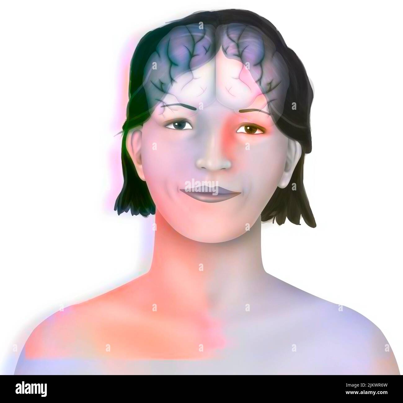 Cervello (emisferi cerebrali destro e sinistro) nel volto di una donna. Foto Stock