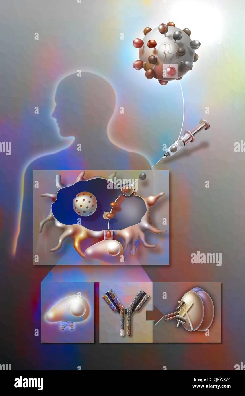 Primo tentativo di cercare un virus contro l'AIDS iniettando gp120 molecole nel corpo. Foto Stock