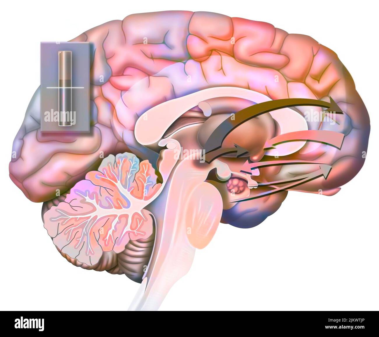 Desiderio e rottura (stato 1): Reazione del cervello alla nascita del desiderio di amore. Foto Stock Desiderio e rottura (stato 1): Reazione del cervello alla nascita del desiderio di amore. Foto Stock