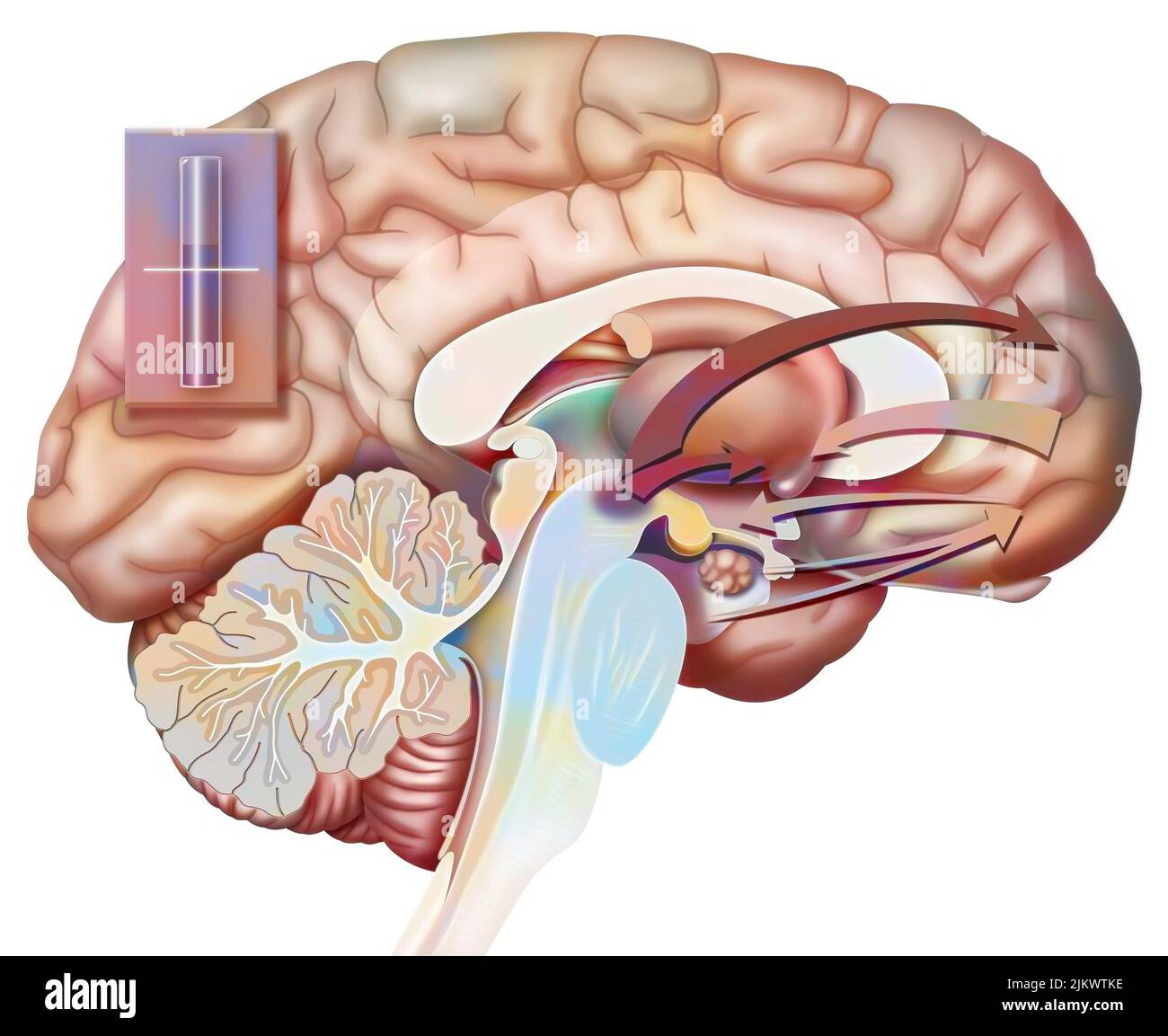 Desiderio e rottura (stato 1): Reazione del cervello alla nascita del desiderio di amore. Foto Stock Desiderio e rottura (stato 1): Reazione del cervello alla nascita del desiderio di amore. Foto Stock