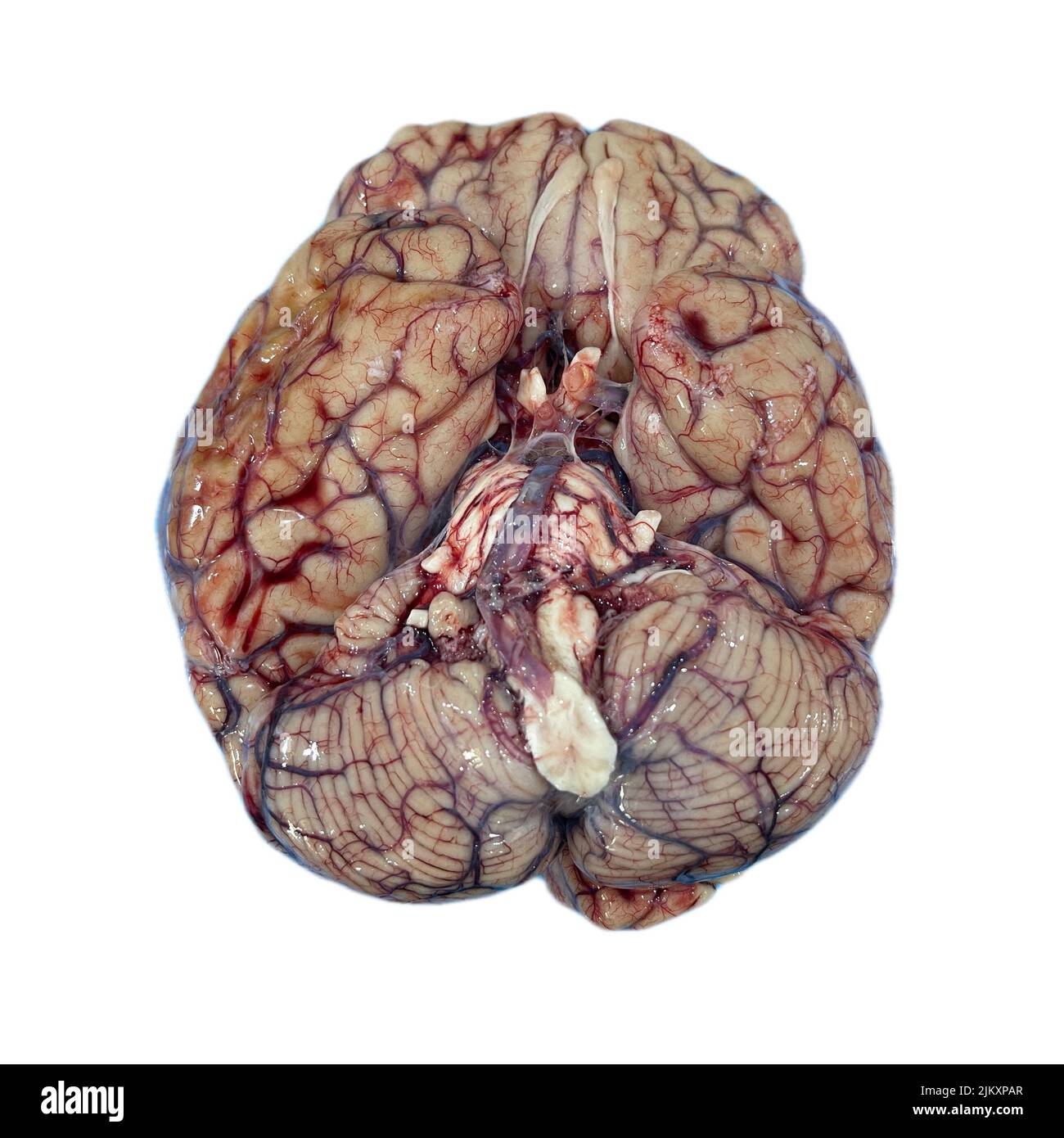 Un primo piano del cervello umano su sfondo bianco Foto Stock