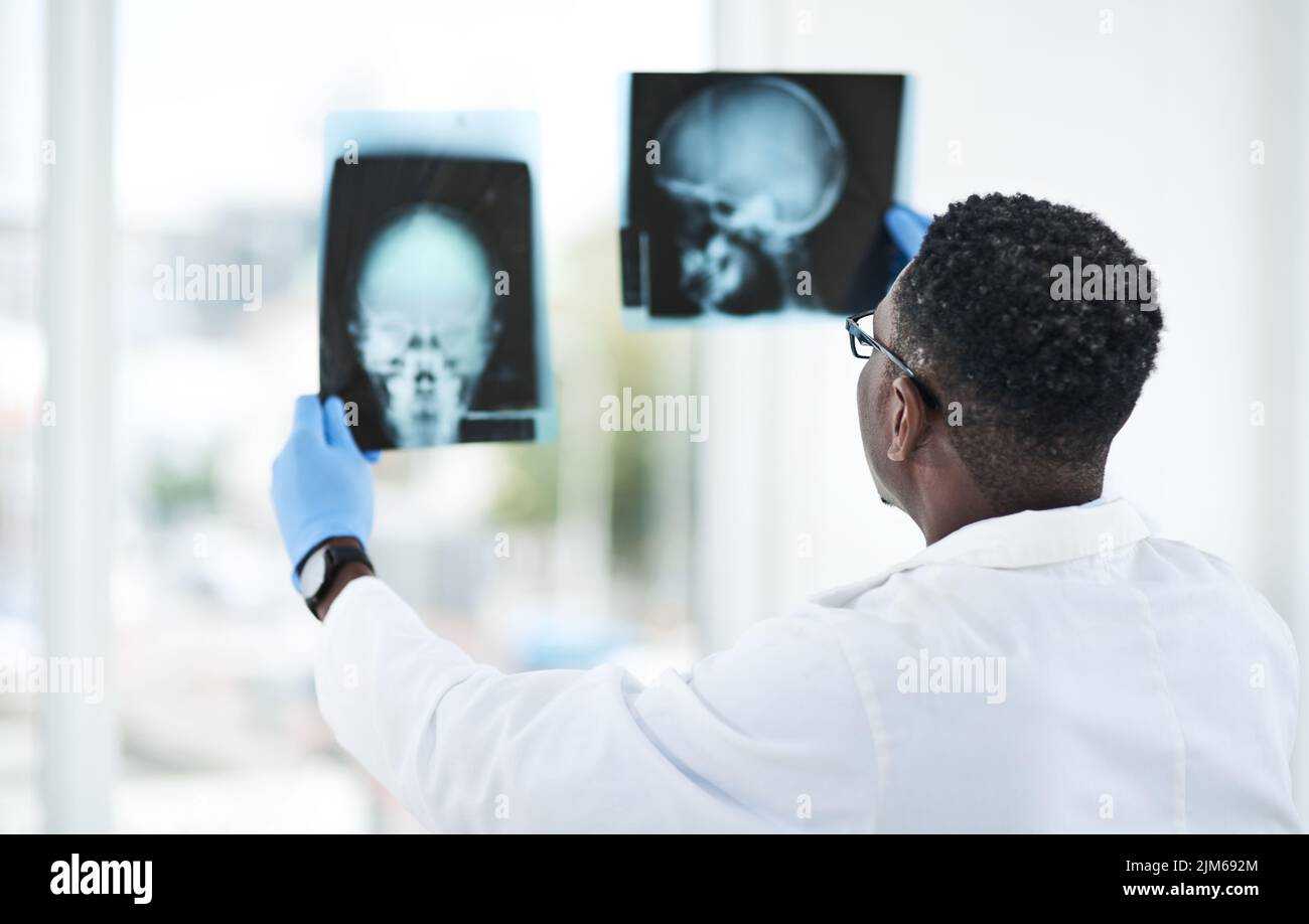 Il maestro in materia della mente. Un giovane medico che analizza una radiografia di un cranio del paziente. Foto Stock
