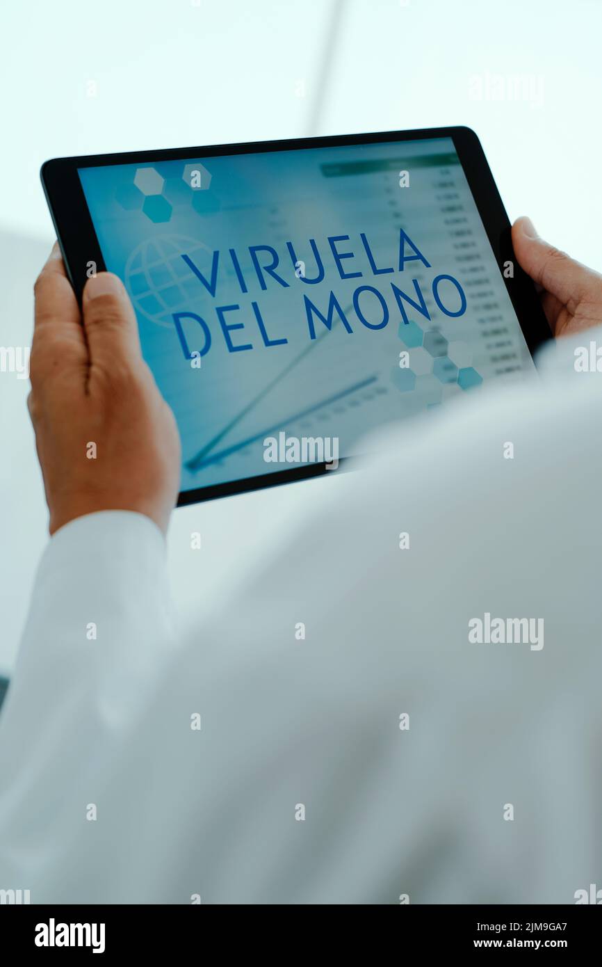 primo piano di un medico, in un cappotto bianco, con una tavoletta digitale nelle sue mani con il testo scimmipox scritto in spagnolo nel suo schermo Foto Stock
