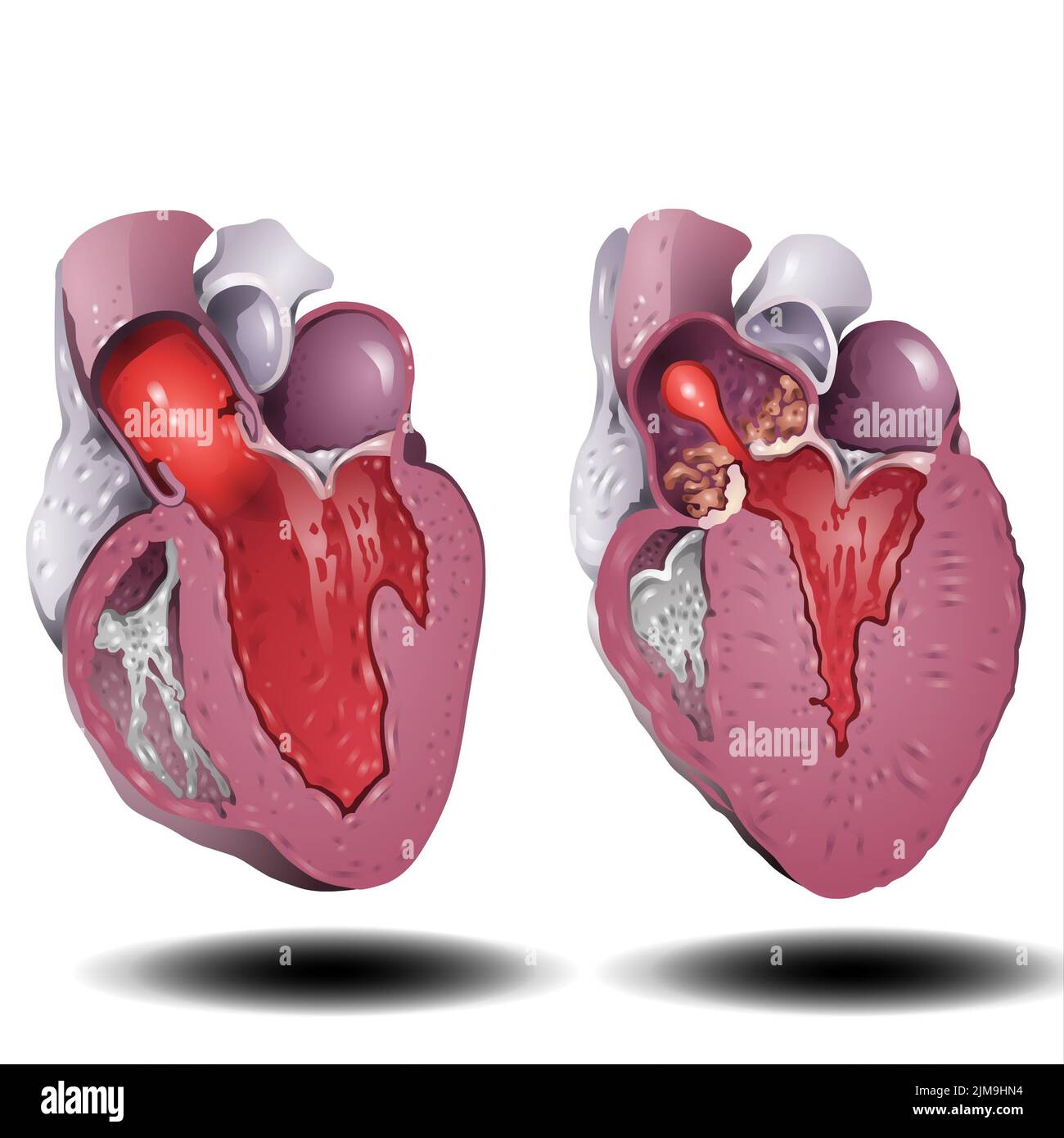 Cuore umano. Anatomico muscoloso umano pompe organo sanguigno, organo interno tagliato con sistema circolatorio. Vettore simbolo del cuore su sfondo bianco Foto Stock