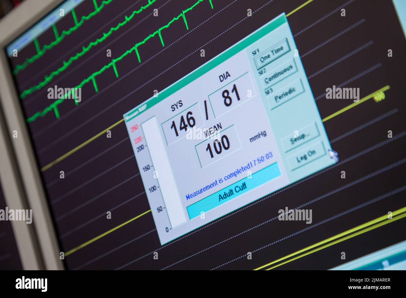 La pressione sanguigna Monitor per la frequenza cardiaca Foto Stock