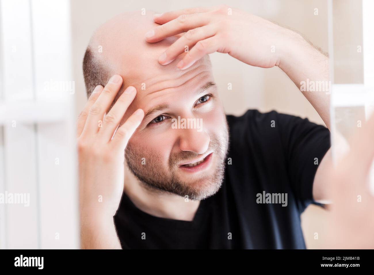 Calvo uomo guardando specchio di calvizie e perdita di capelli Foto Stock