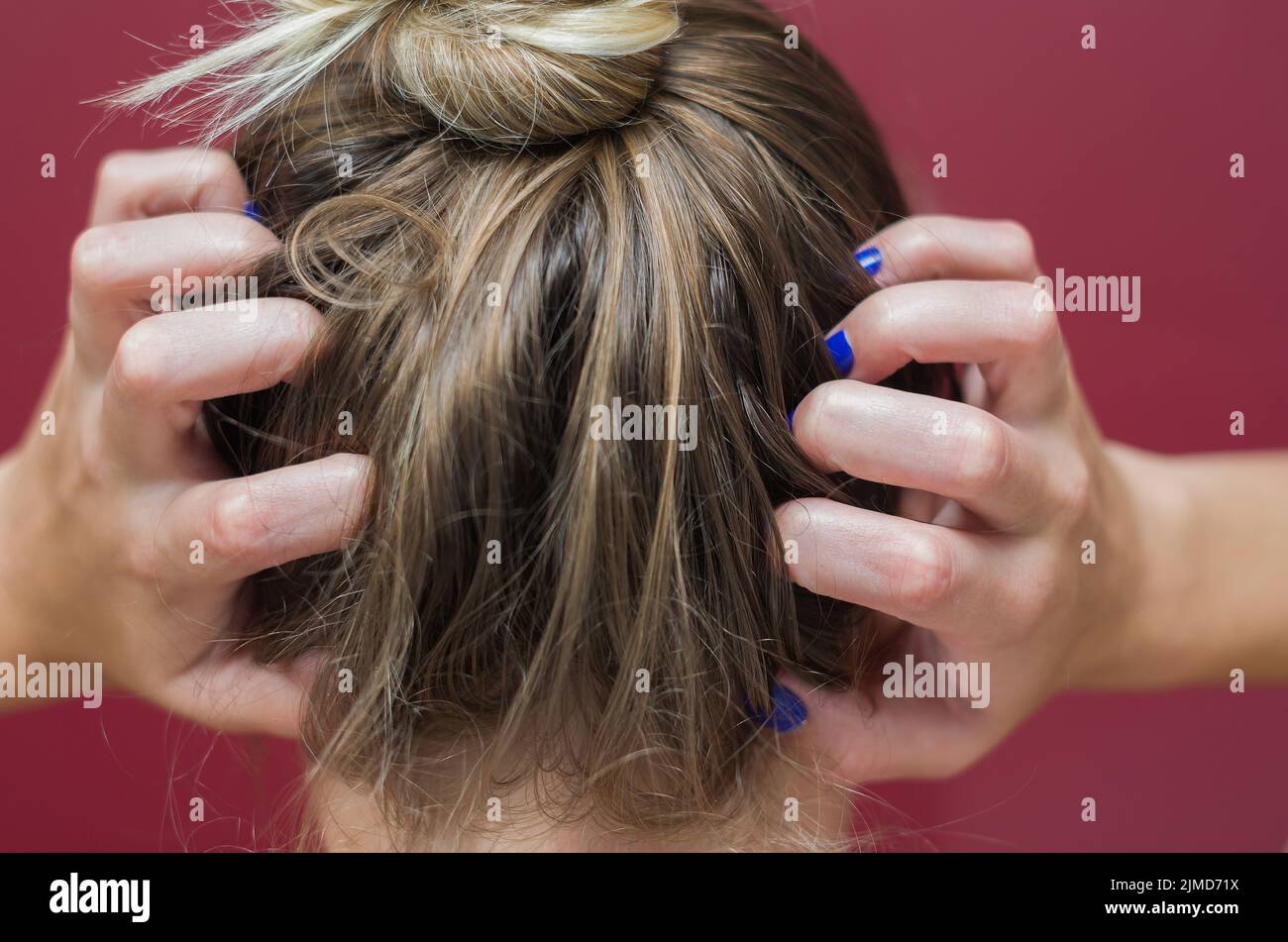 Grande concetto di allergie e malattie della pelle, giovane donna di graffiare la sua testa. Foto Stock