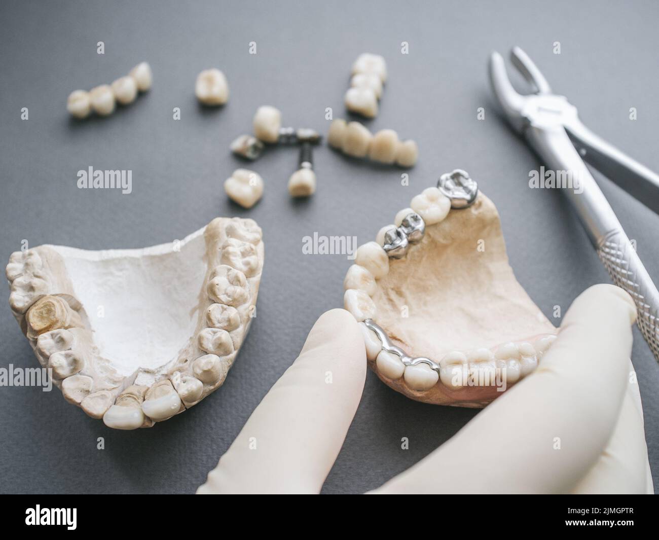 protesi dentaria ganasce dentaria corone forcipi Foto Stock