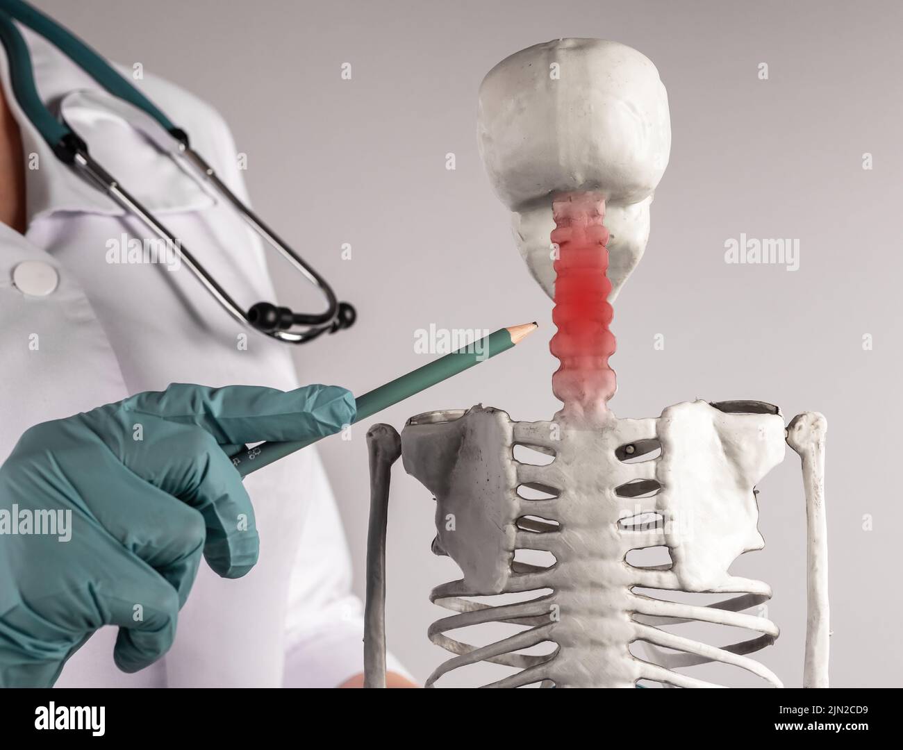Medico che punta allo scheletro della colonna cervicale con macchia rossa. Dolore al collo. Anatomia del sistema scheletrico, medicina, concetto di condizioni mediche. Donna in camice da laboratorio Foto Stock