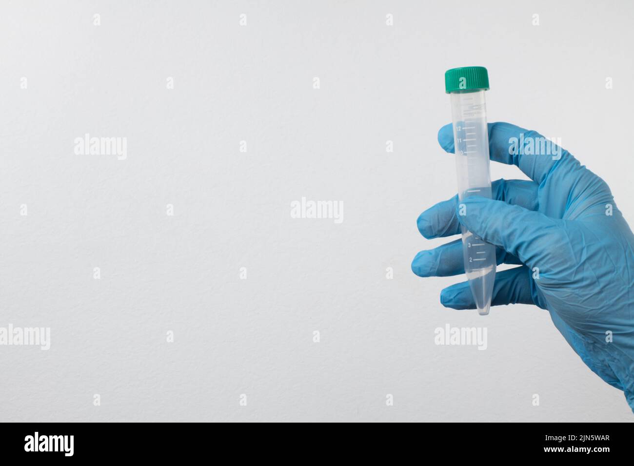 provetta sottovuoto per il prelievo e campioni di sangue in guanti blu per laboratorio. Su sfondo bianco Foto Stock