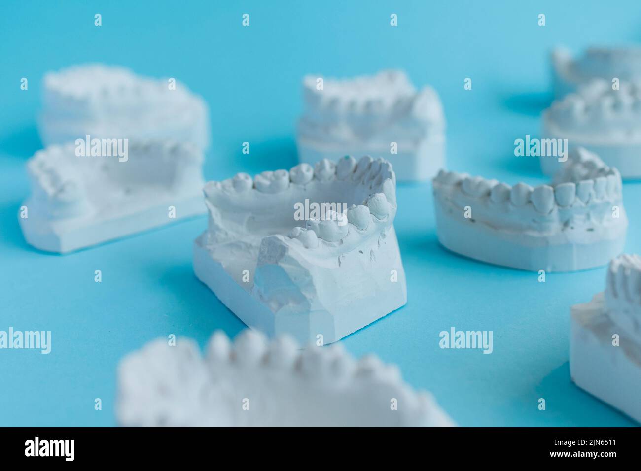 Calchi dentali in gesso delle ganasce Foto Stock