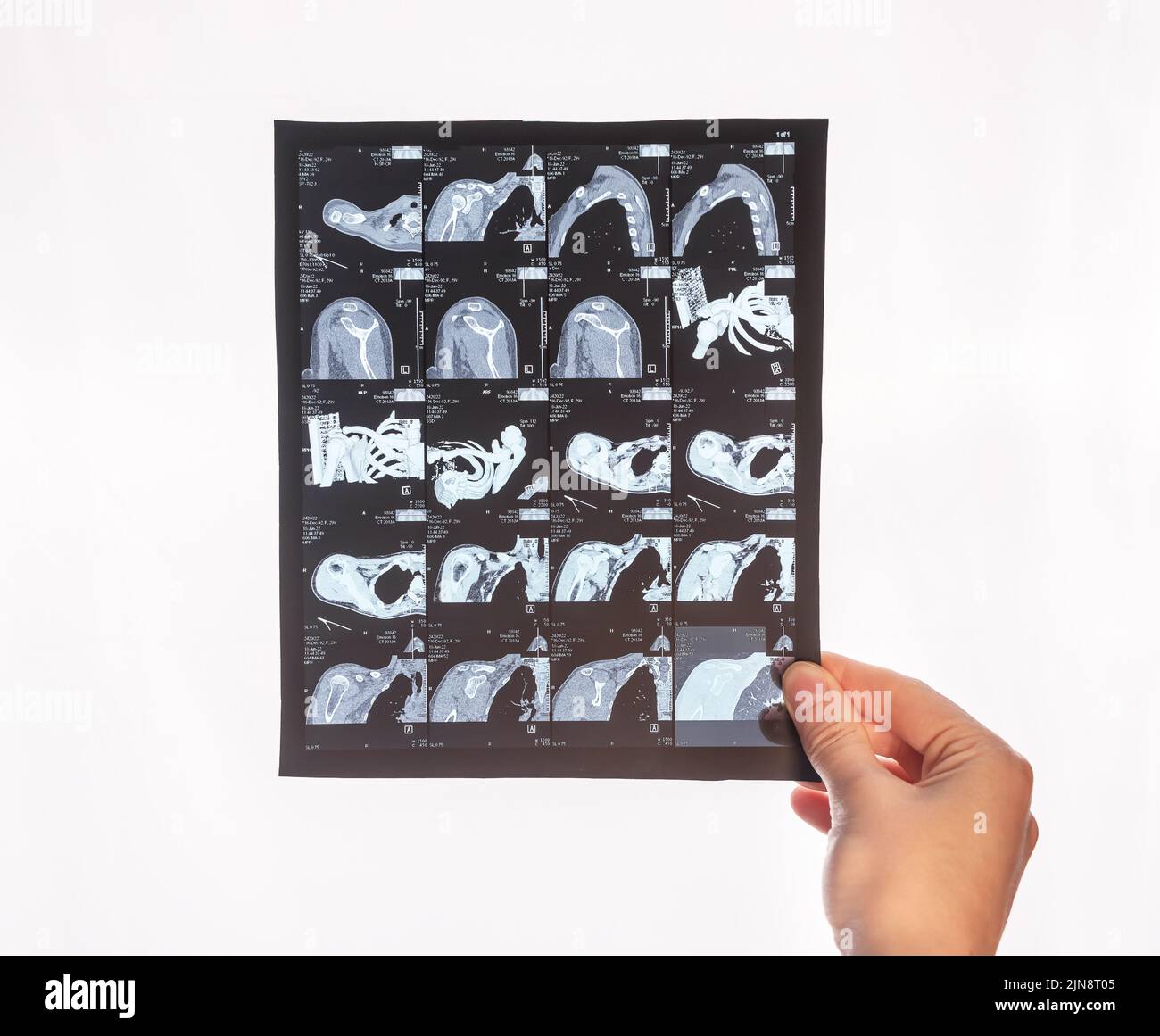 TC. Immagine di scansione tomografica computerizzata con supporto manuale. Diagnosi di malattie, controllo di lesioni, trauma, rilevamento di tumori. Assistenza sanitaria, medicina concep Foto Stock