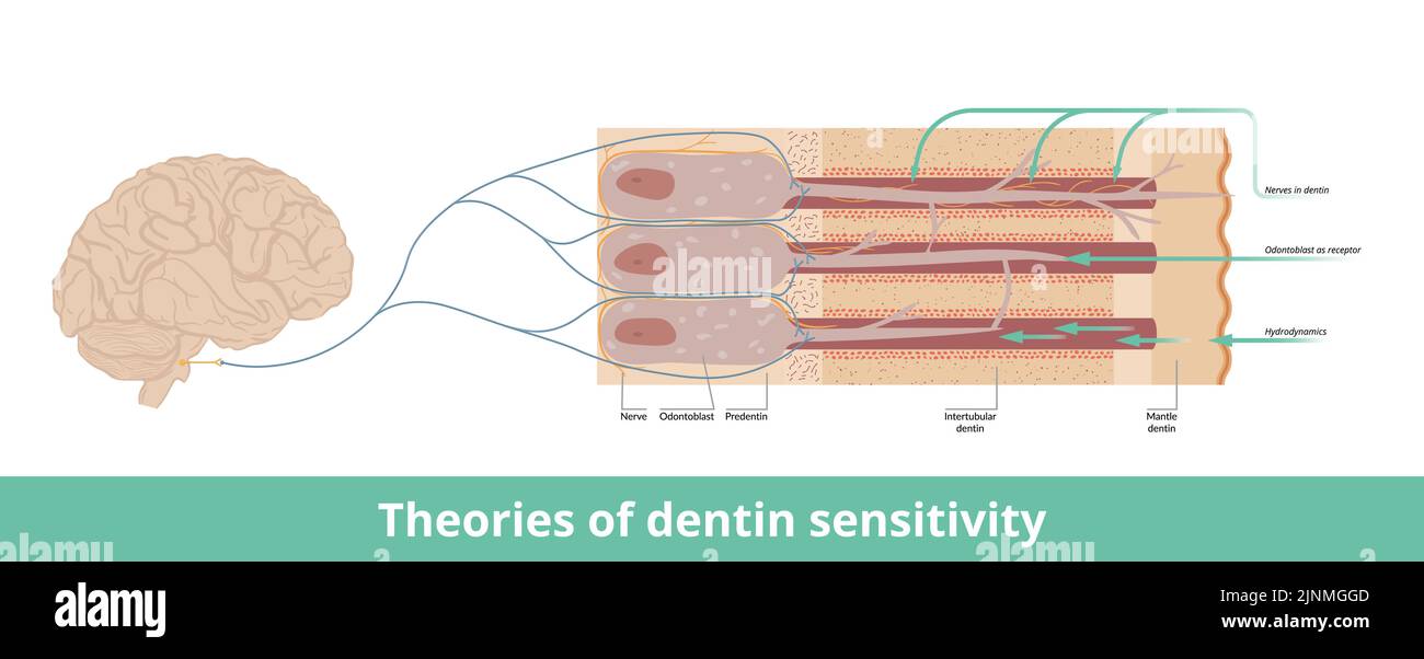 Teorie della sensibilità dentina. Visualizzazione della sensibilità della dentina derivante da diverse fonti: Nervi, odontoblasti come recettore e idrodinamica Illustrazione Vettoriale