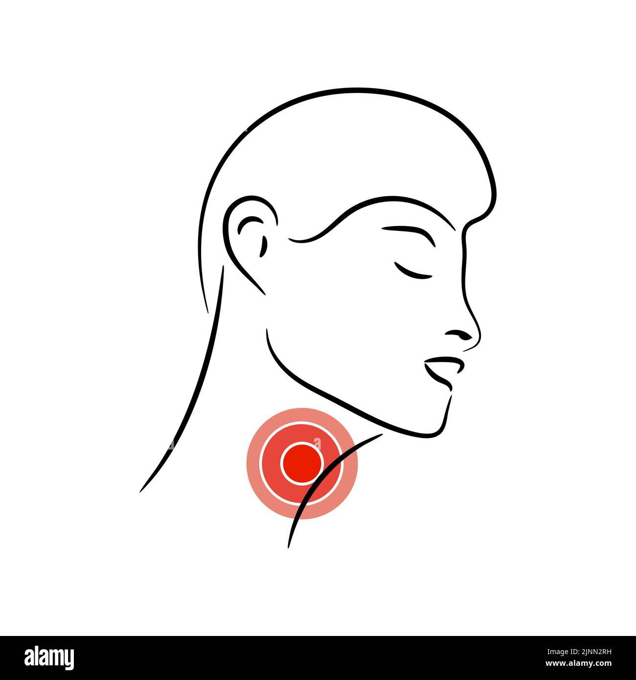 Illustrazione del vettore della gola irritata. Sensazione di dolore alla gola. Design del logo Illustrazione Vettoriale