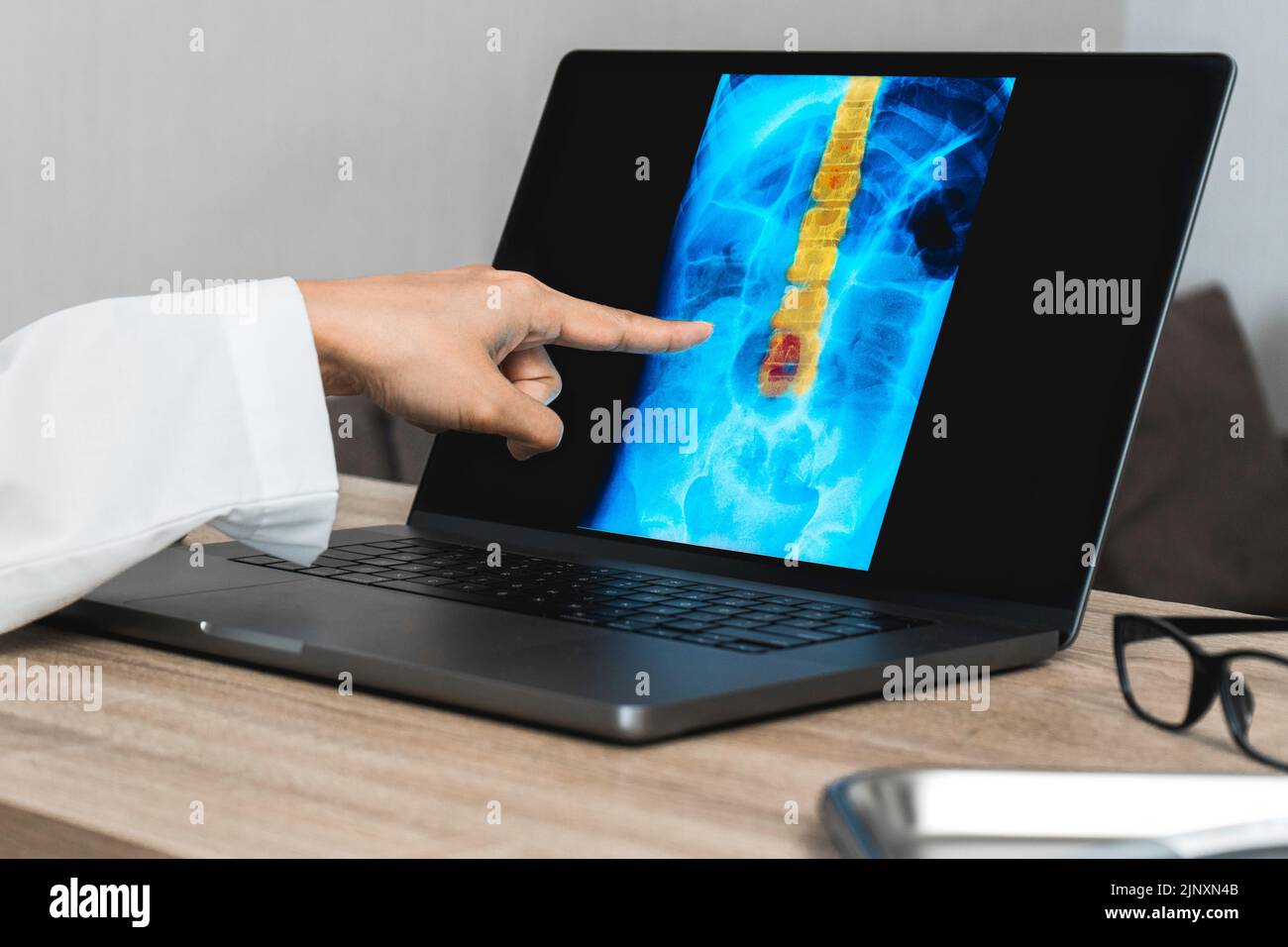 Medico che mostra una radiografia di dolore nella colonna vertebrale. Trauma da mal di schiena Foto Stock