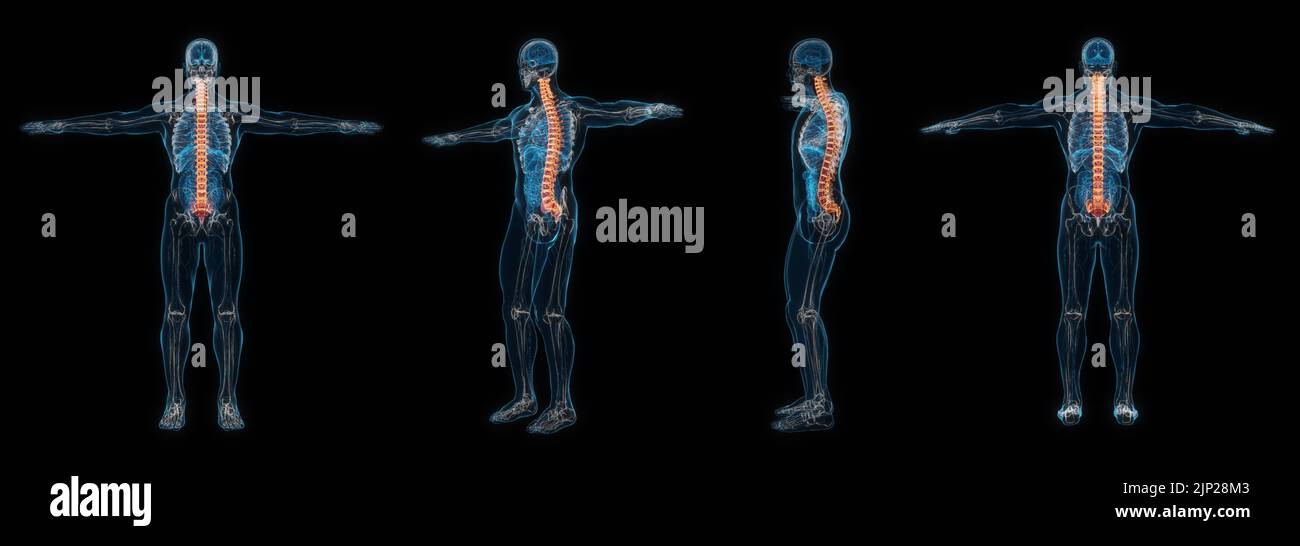 3d set di rappresentazione di raggi x della colonna vertebrale del corpo umano maschio isolato su sfondo nero. Foto Stock