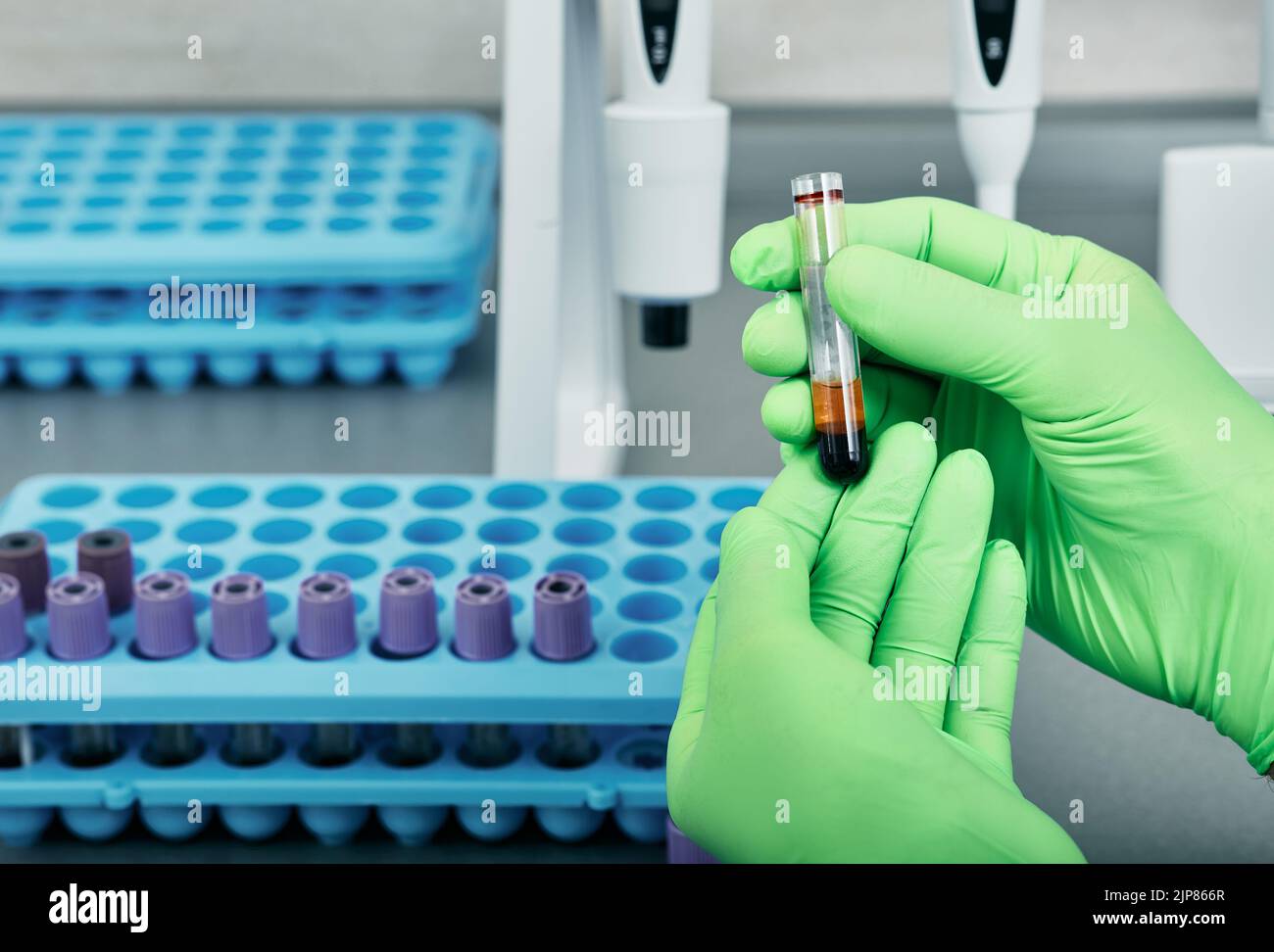 Tecnico di laboratorio con guanti protettivi che lavora con le provette per analisi del sangue Foto Stock