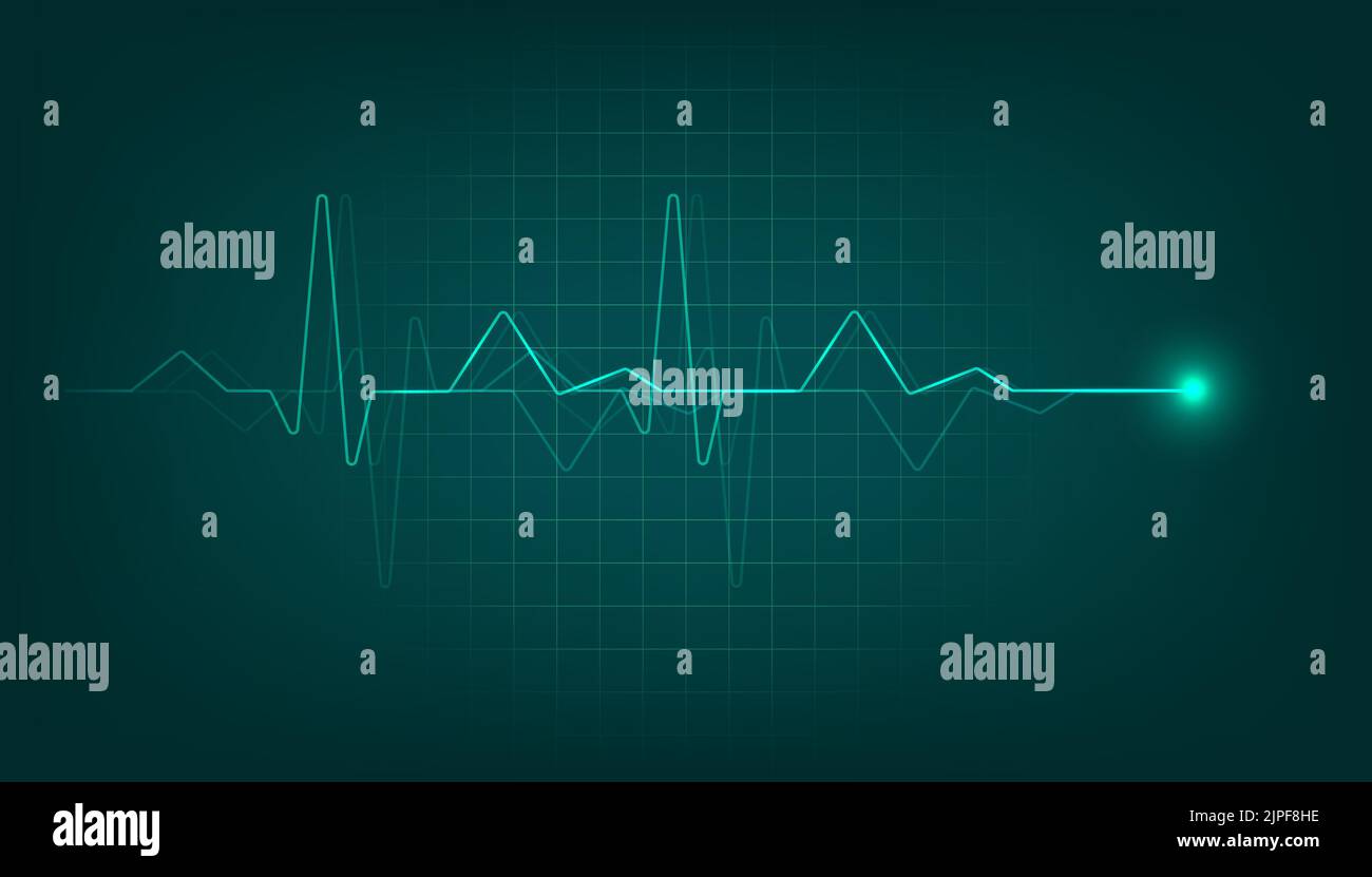 Monitor del polso cardiaco verde con segnale. Sfondo del cardiogramma del battito cardiaco. Illustrazione Vettoriale