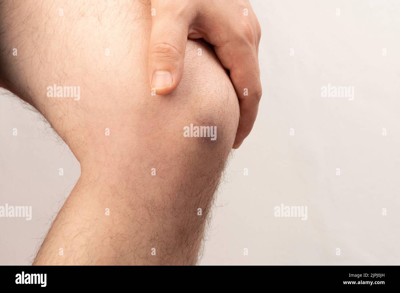 Massaggio ginocchio tema. Applicazione della crema sul ginocchio ferito Foto Stock