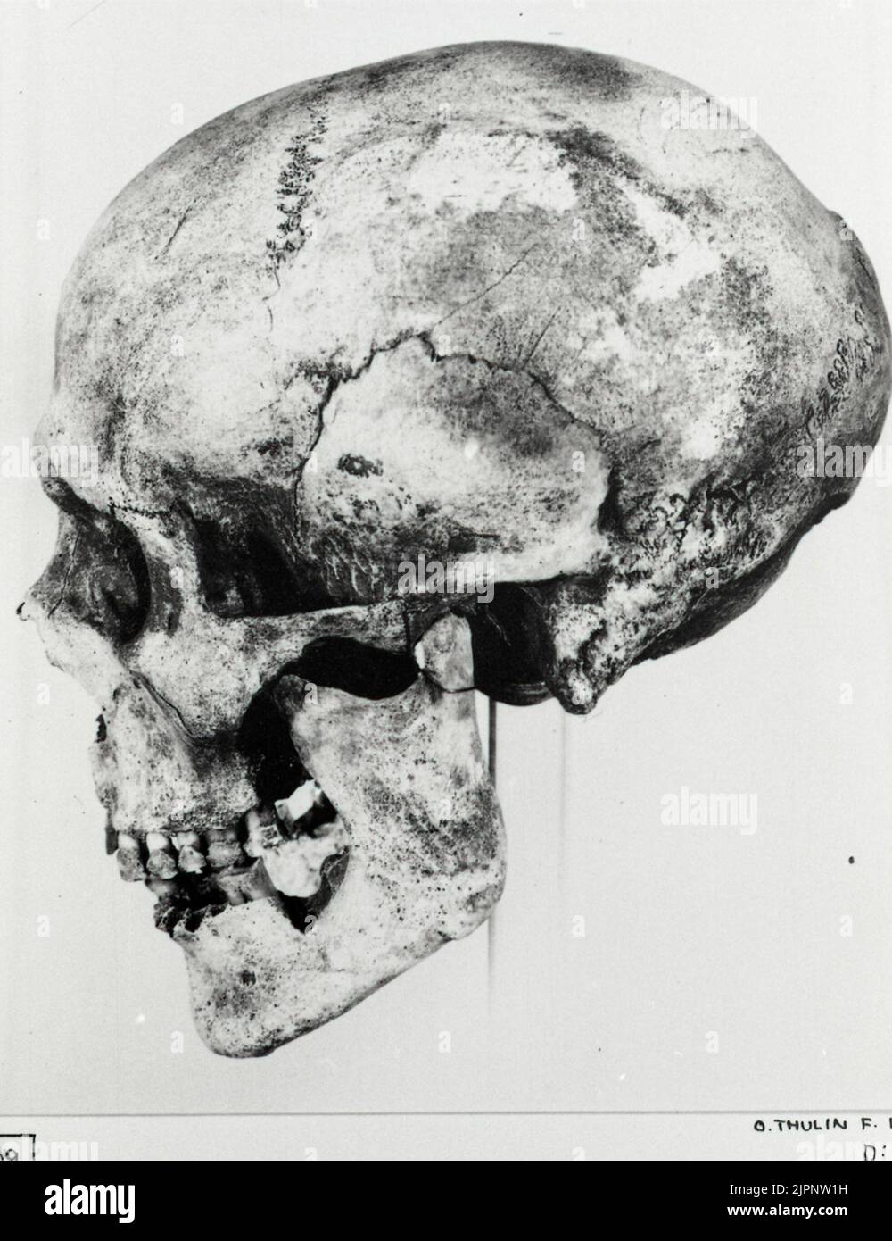 Tomba 15. Un cranio dal lato. Grigio 15. Ett kranium från sidan. Foto Stock