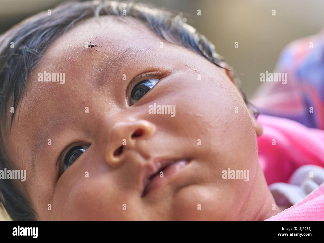Una zanzara sulla fronte di un bambino. Foto Stock