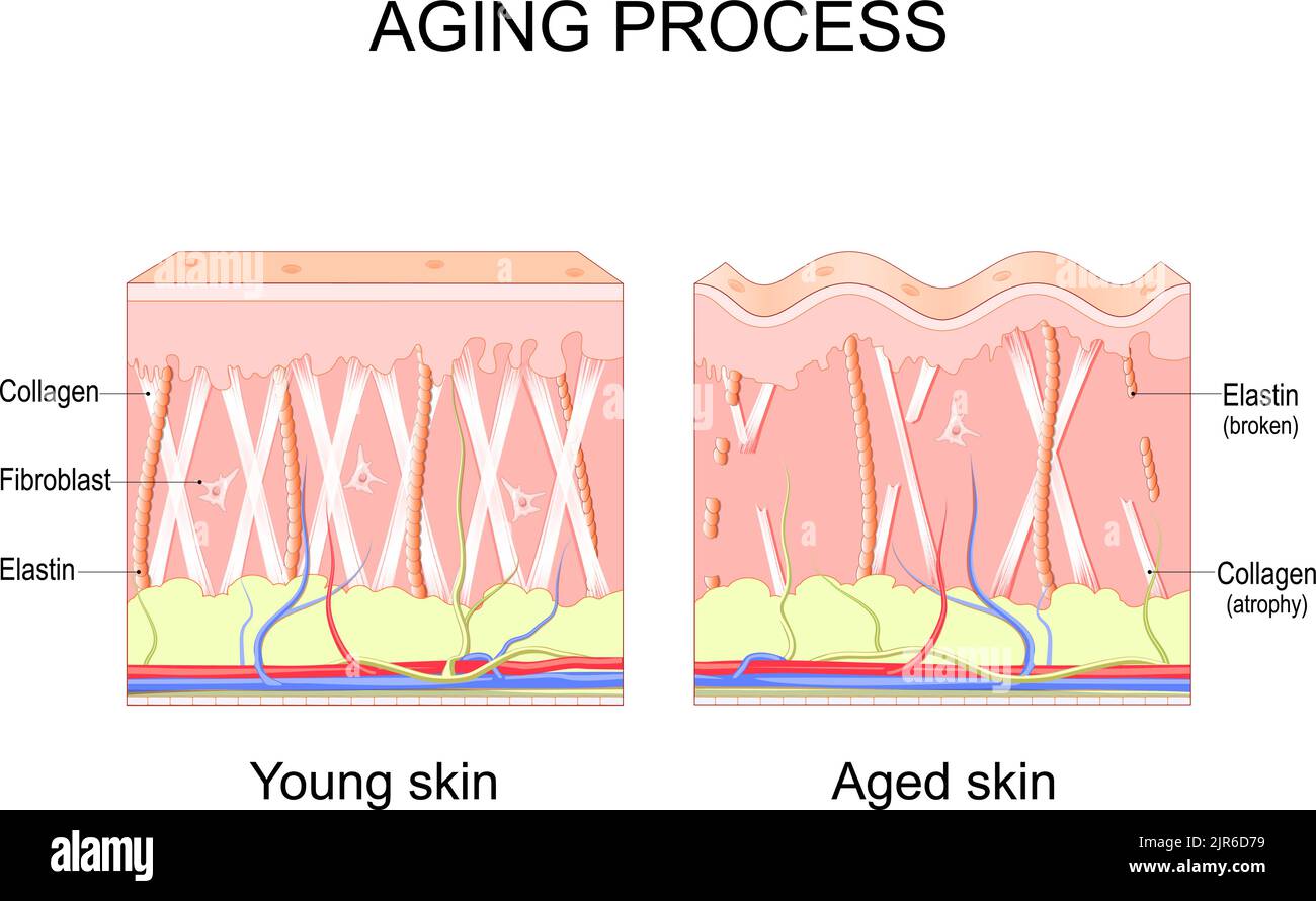 Processo di invecchiamento confronto tra pelle giovane e invecchiata. Collagene, elastina e fibroblasti nella pelle più giovane e più anziana alterazioni della pelle legate all'età Illustrazione Vettoriale