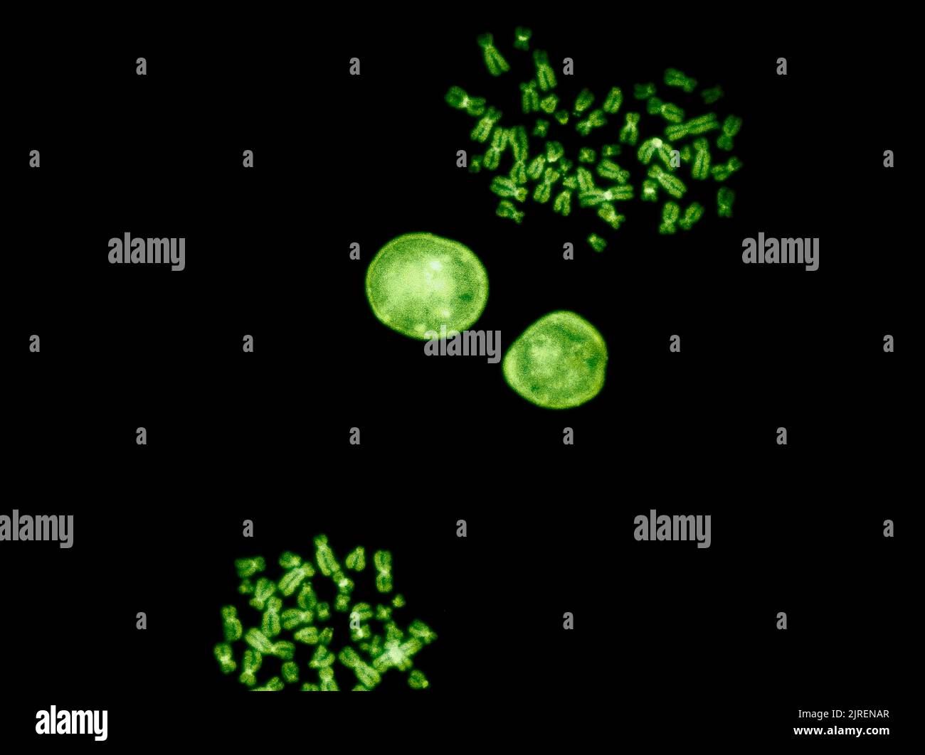 Cromosomi al microscopio a fluorescenza, di colore verde cromosomi umani dal sangue Foto Stock