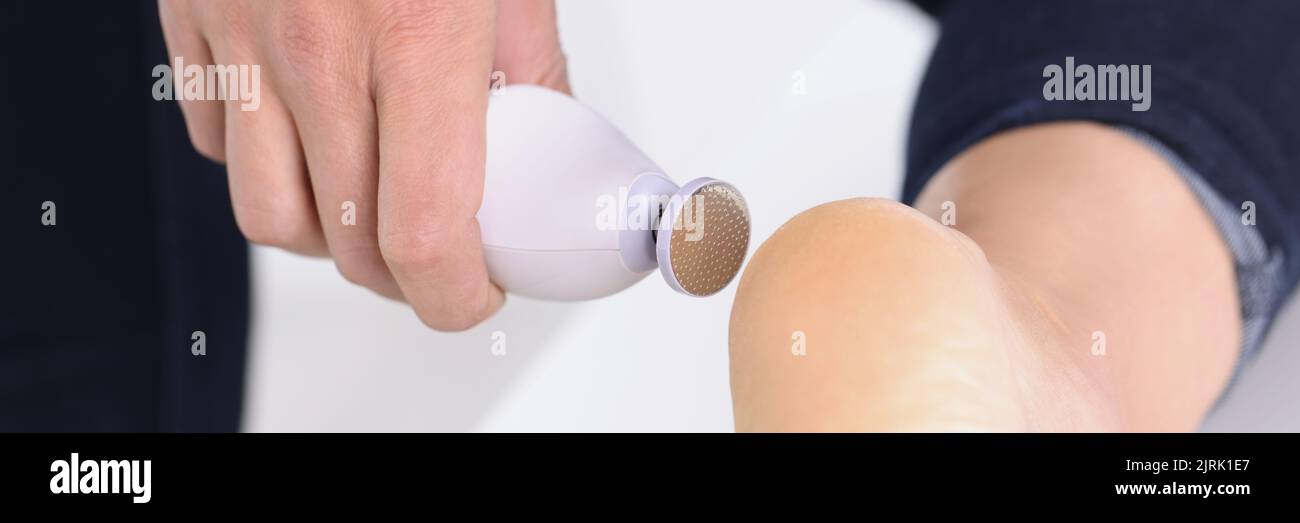 Pedicure e cura dei piedi. Cura del corpo e massaggio per la pelle secca dei piedi e delle dita dei piedi Foto Stock