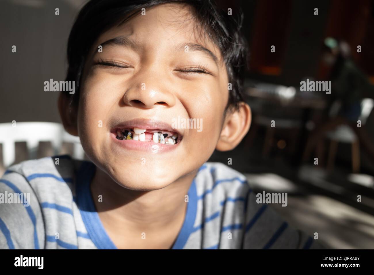 Il ragazzino del sud-est asiatico sorride mostrando problemi dentali Foto Stock