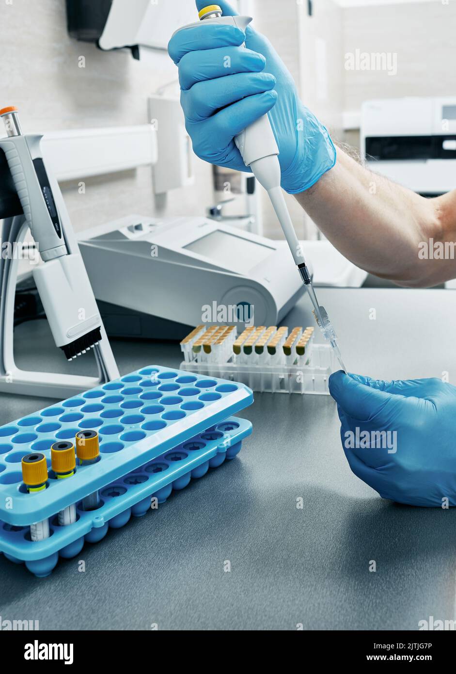 Tecnico di laboratorio con micropipetta per analisi di analisi determina il tipo di sangue della persona utilizzando la tecnologia gel, primo piano Foto Stock