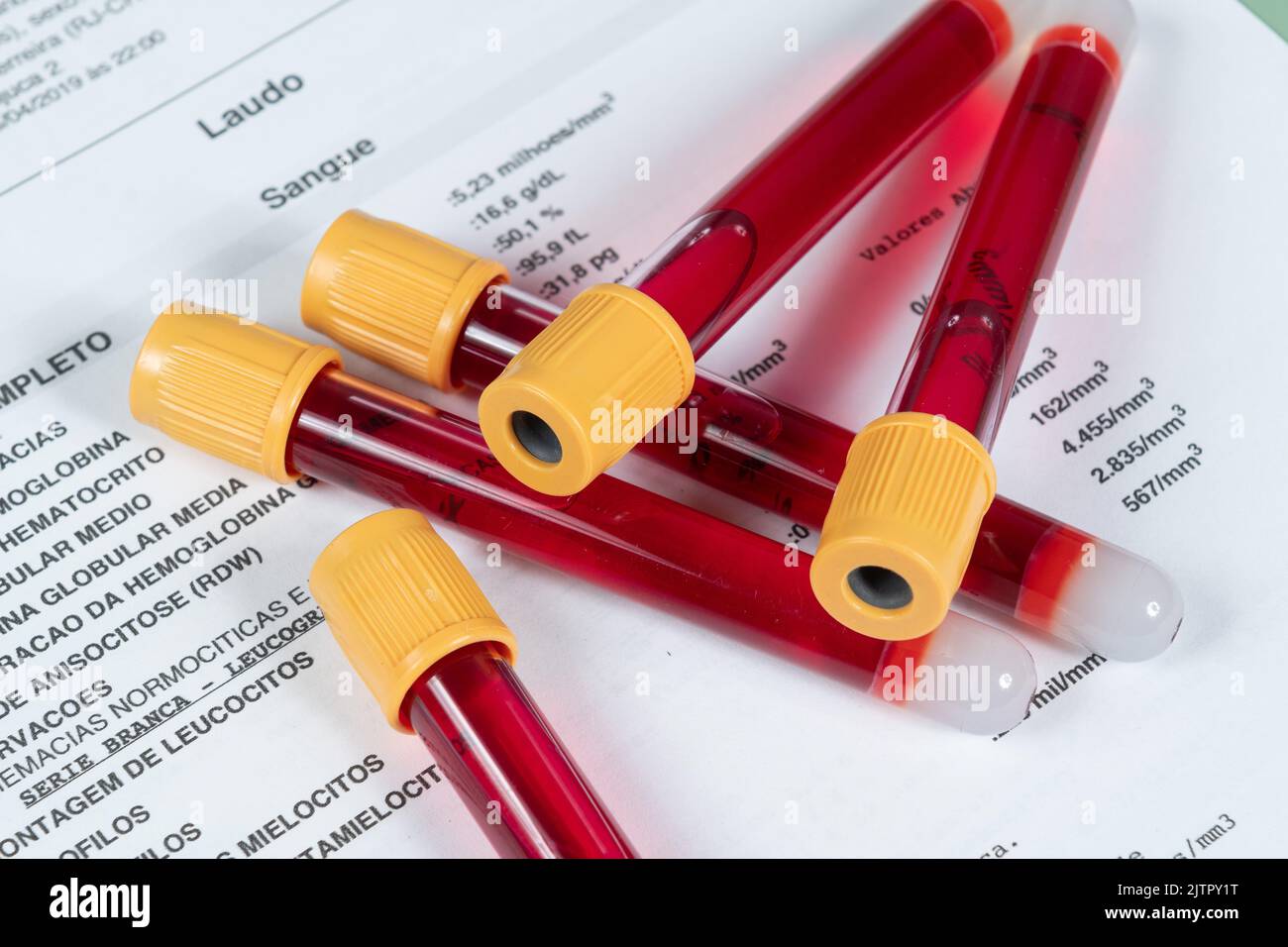 provetta a vuoto per analisi del sangue sulla scheda dei risultati dell'analisi clinica Foto Stock