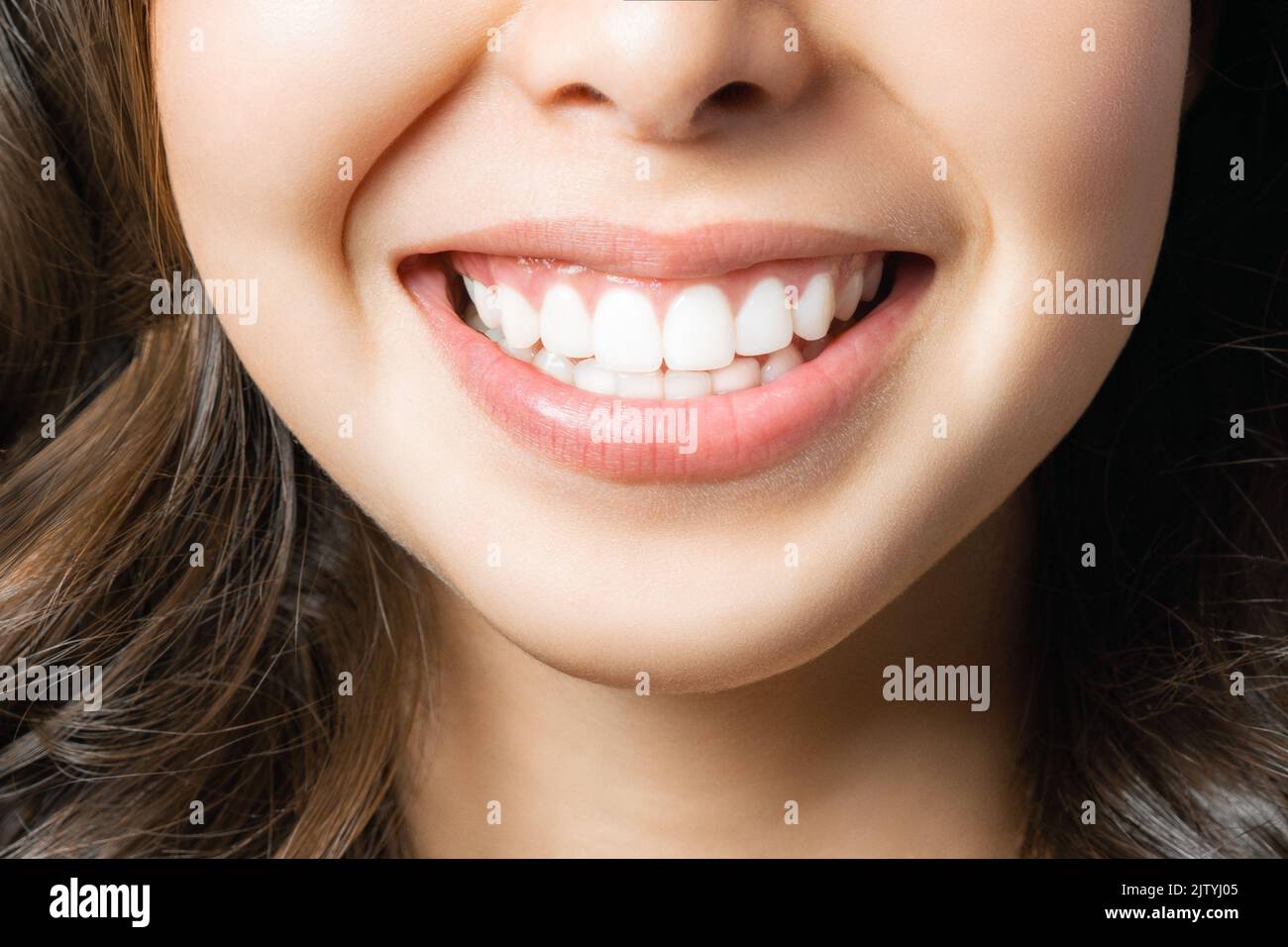 Perfetta dei denti sani sorriso di una giovane donna. Lo sbiancamento dei denti. Clinica dentale del paziente. Immagine simboleggia la cura orale odontoiatria, stomatologia Foto Stock