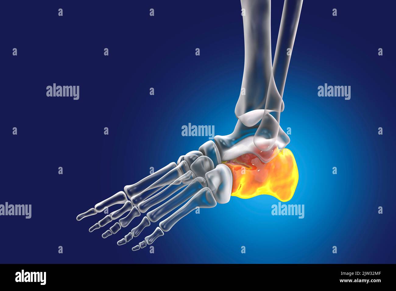 Illustrazione del calcagno o del tallone, osso del piede. Foto Stock