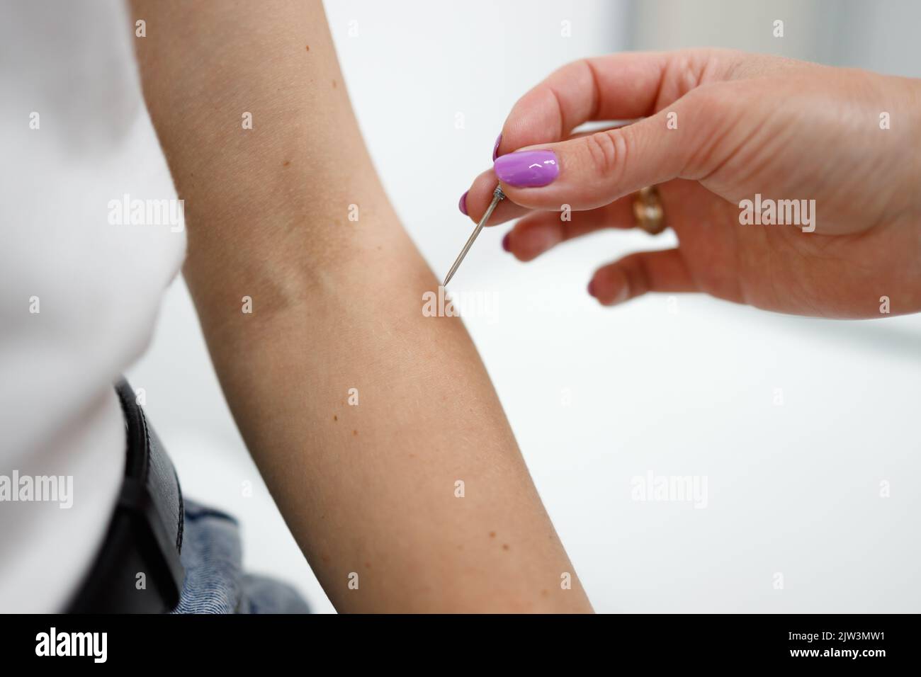 Vista ravvicinata di un medico neurologo che controlla i riflessi sulla mano di una paziente femmina con un ago speciale. Diagnosi di malattie neurologiche nel cl Foto Stock